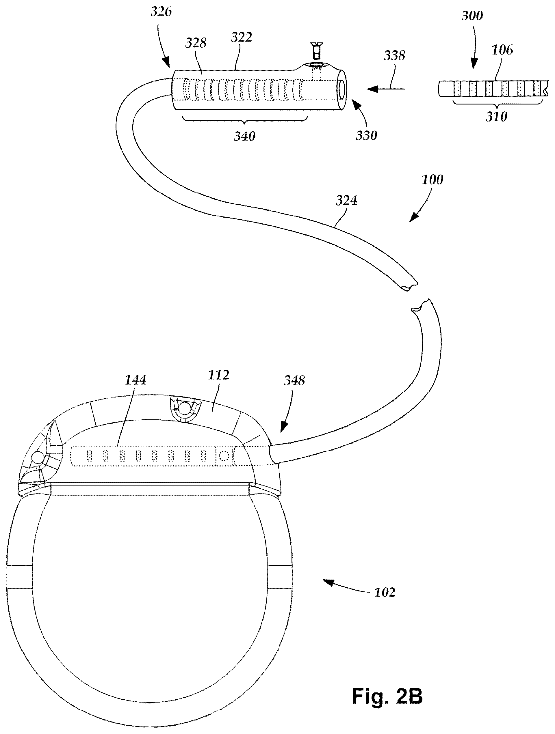 Patent US12324925 Figure 3 – Implantable optical stimulation lead and methods of making and using