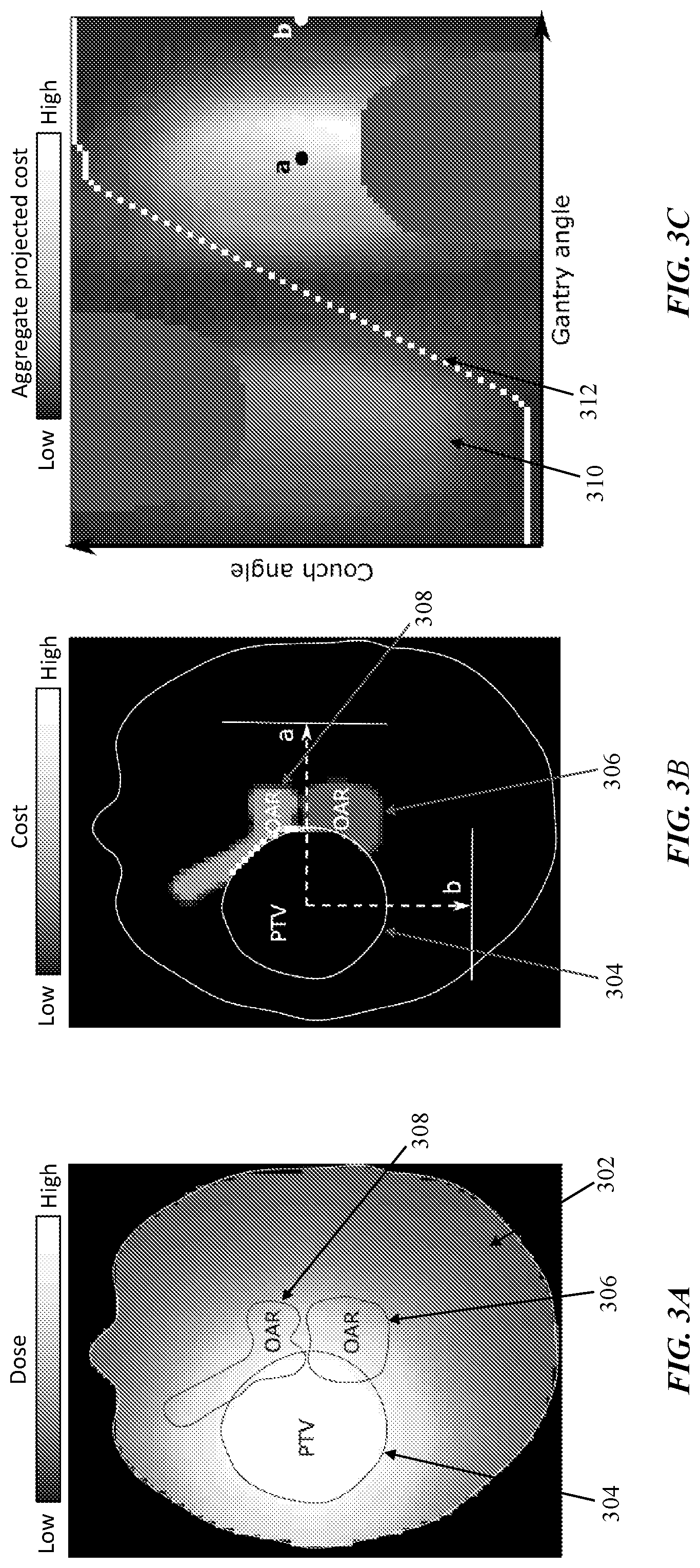 Patent US12324929 Figure 4 – Trajectory optimization using dose estimation and conflict detection