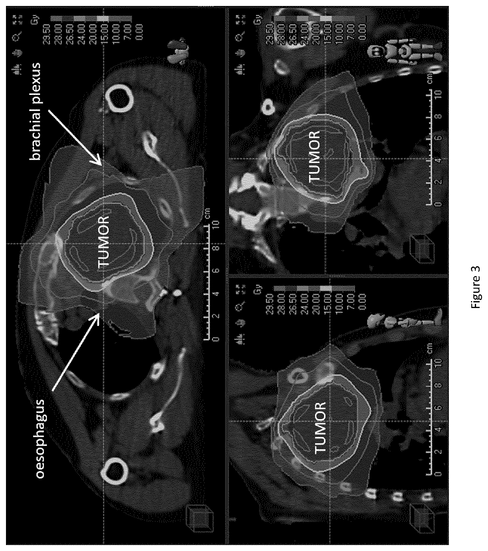 Patent US12324933 Figure 3 – Device for ultra-high dose rate radiation treatment