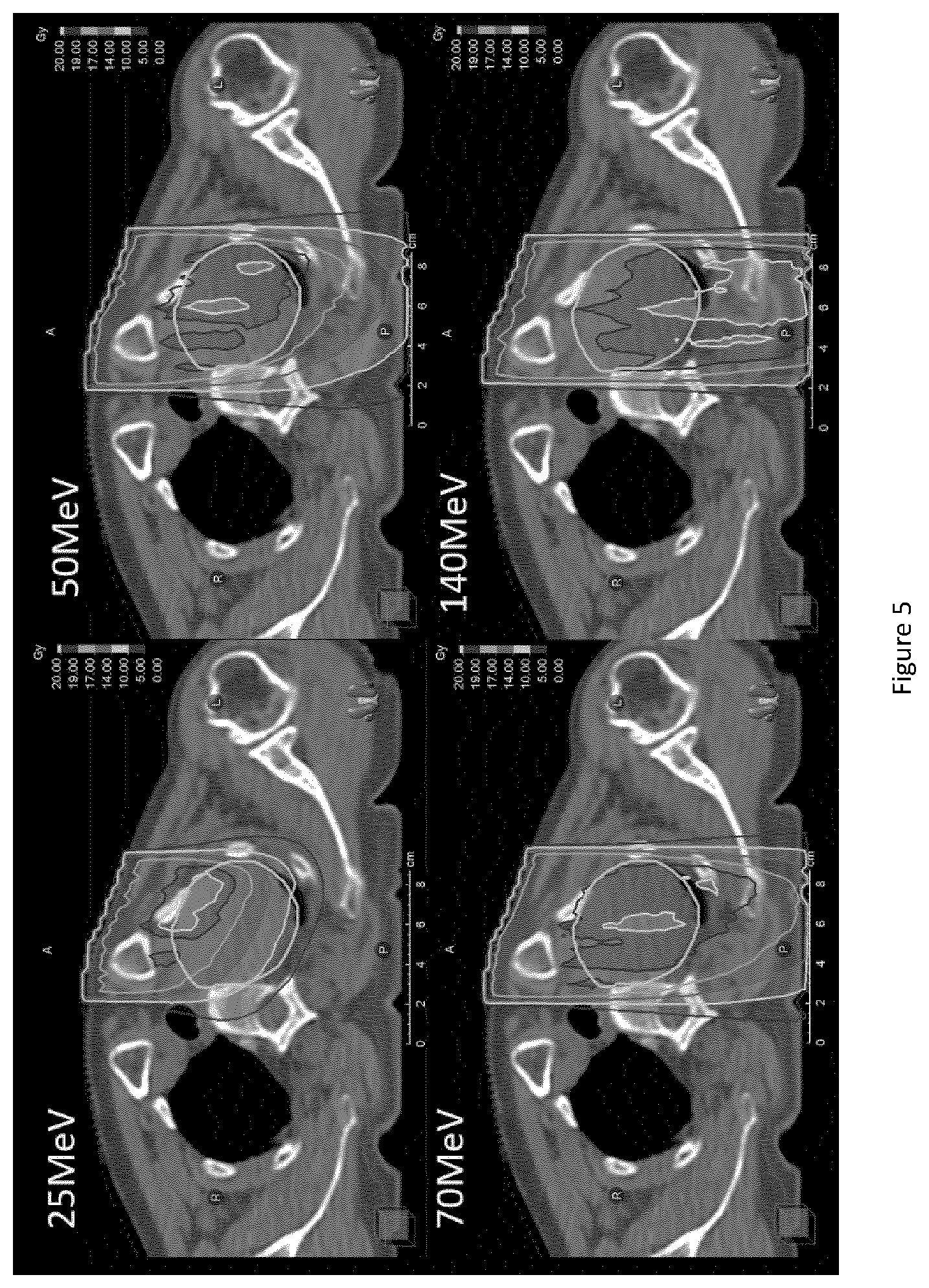 Patent US12324933 Figure 5 – Device for ultra-high dose rate radiation treatment