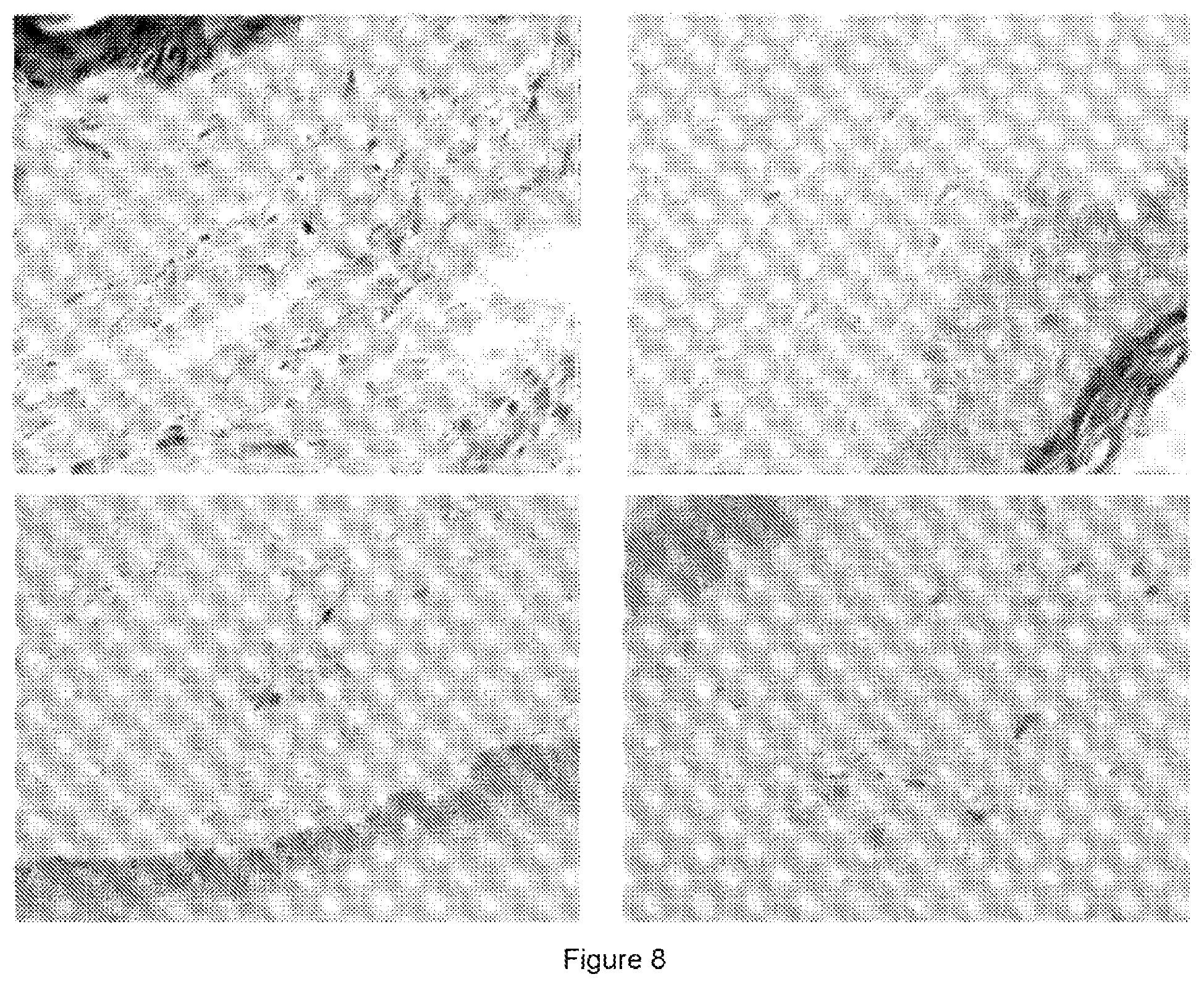 Patent US12324935 Figure 7 – Ultrasound-emitting apparatus for applying selective treatments to adipose tissue in body rejuvenation/remodelling processes