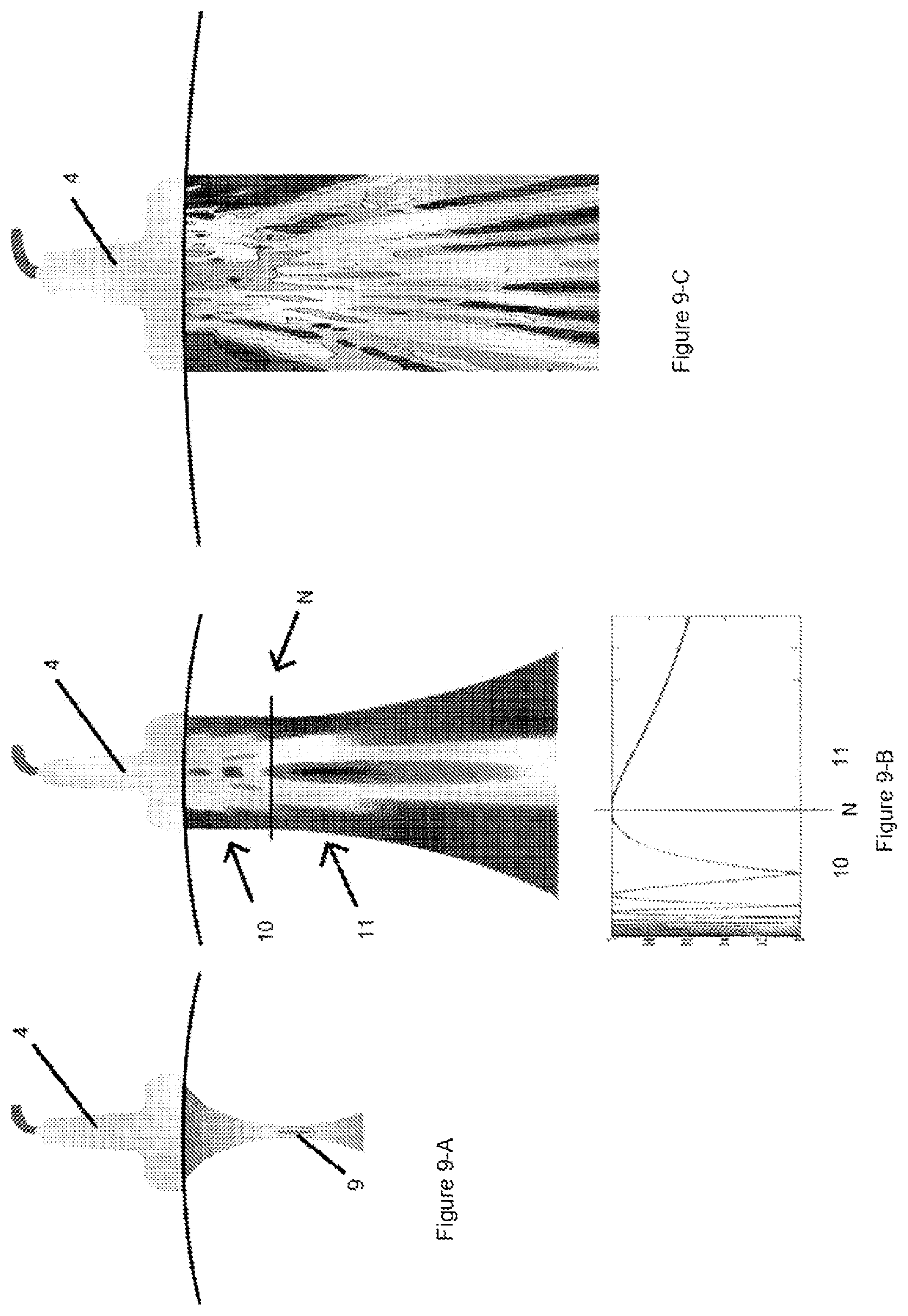 Patent US12324935 Figure 8 – Ultrasound-emitting apparatus for applying selective treatments to adipose tissue in body rejuvenation/remodelling processes