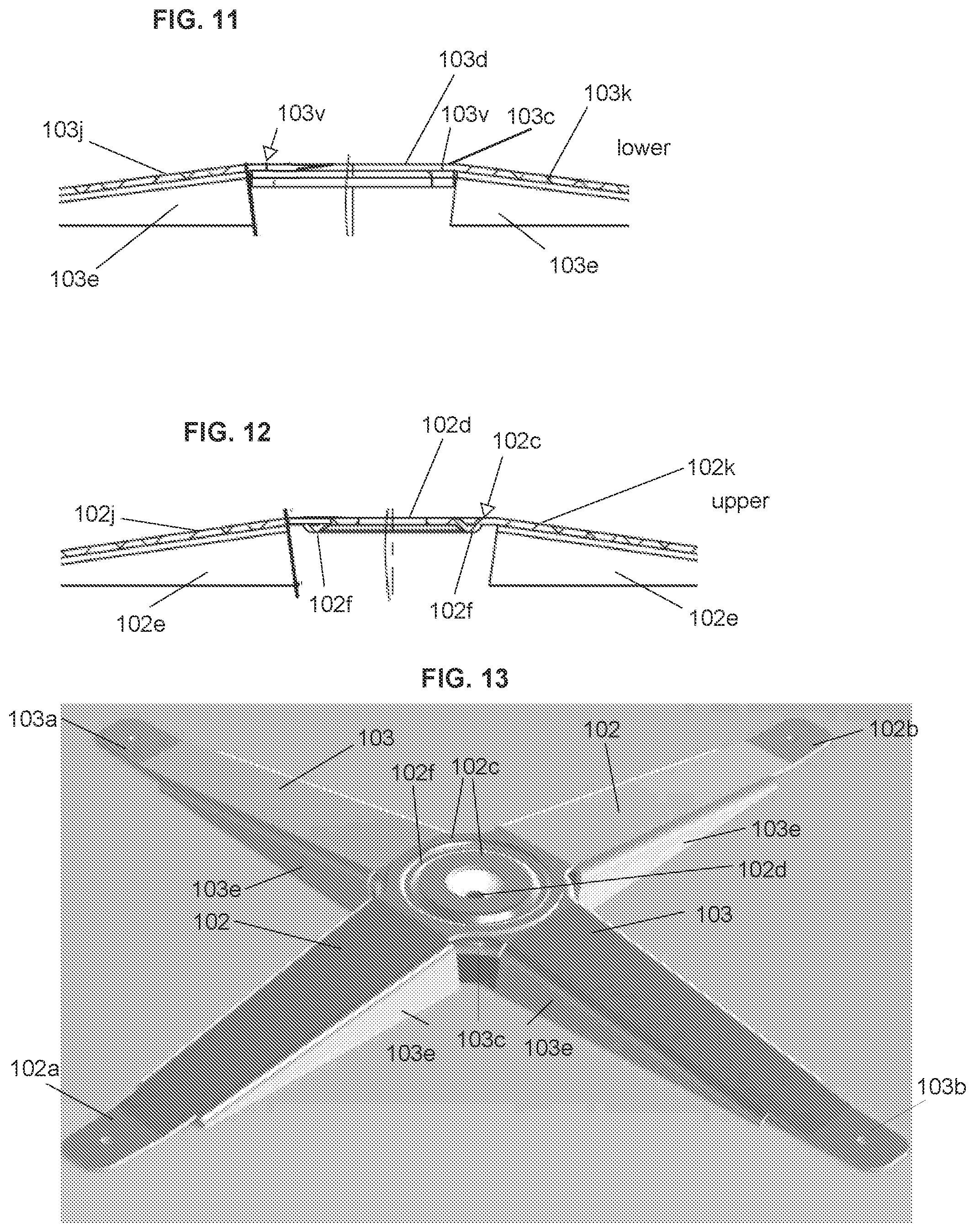 Patent US12324937 Figure 6 – Anchor assembly