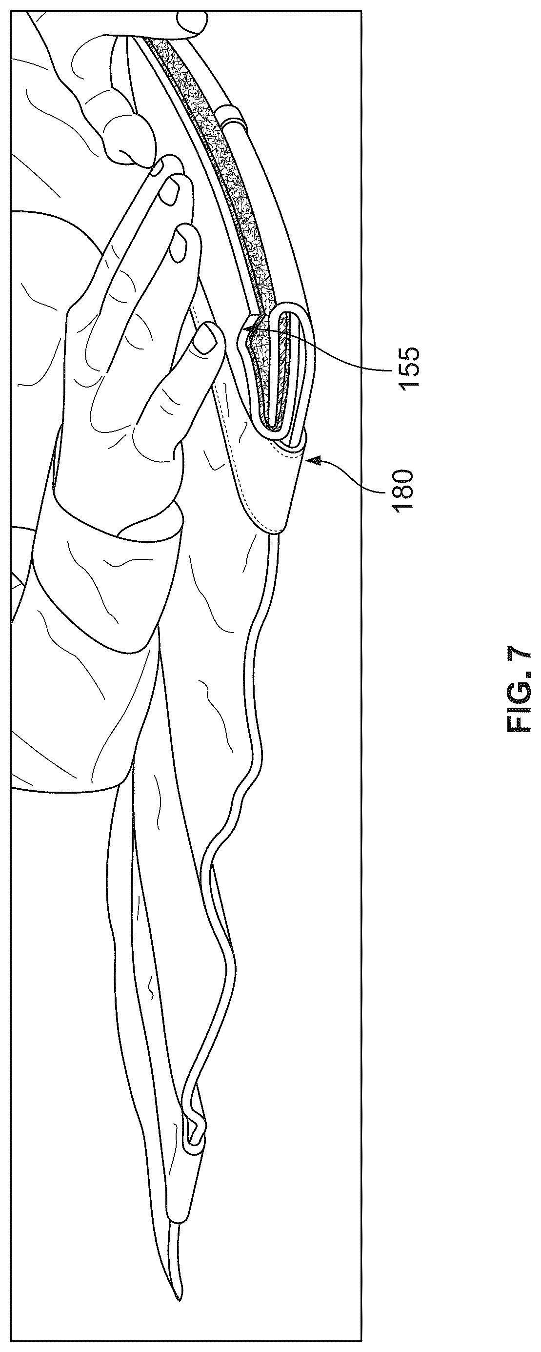 Patent US12324942 Figure 7 – Exercise bag system with multi-locking closure system