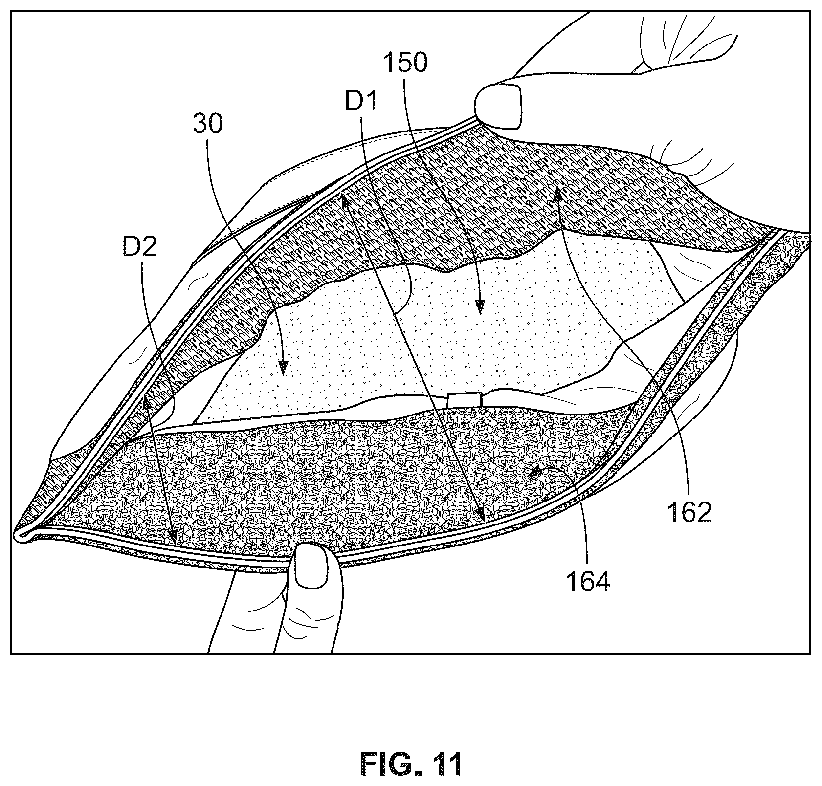 Patent US12324942 Figure 11 – Exercise bag system with multi-locking closure system