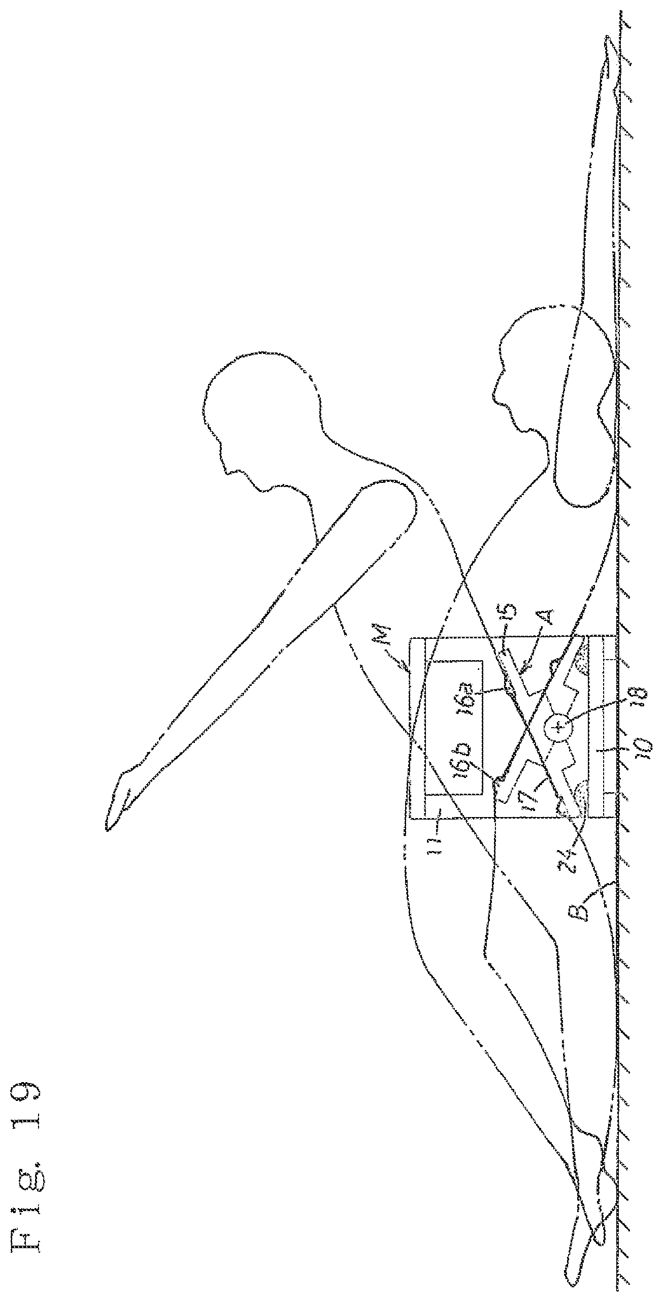 Patent US12324954 Figure 16 – Legless chair type seesaw exercise device