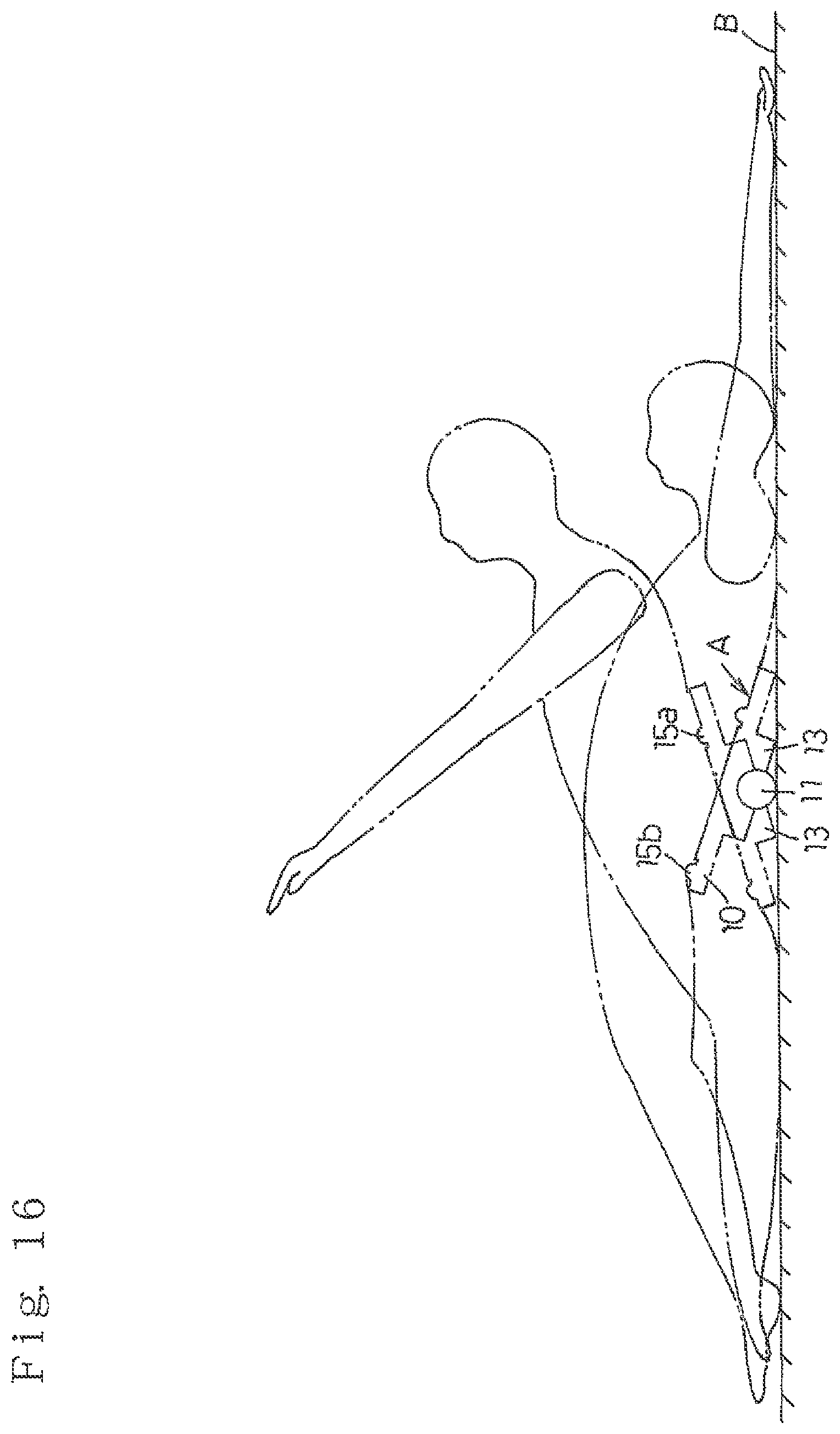 Patent US12324955 Figure 11 – Seesaw exercise device