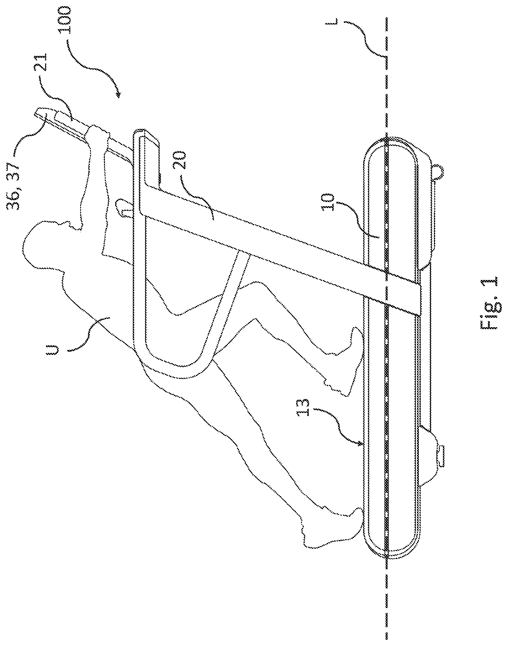 Patent US12324962 Figure 1 – Method for estimating a maximum power value generatable by a user during a resistance training exercise on an exercise machine and exercise machine able to implement said method
