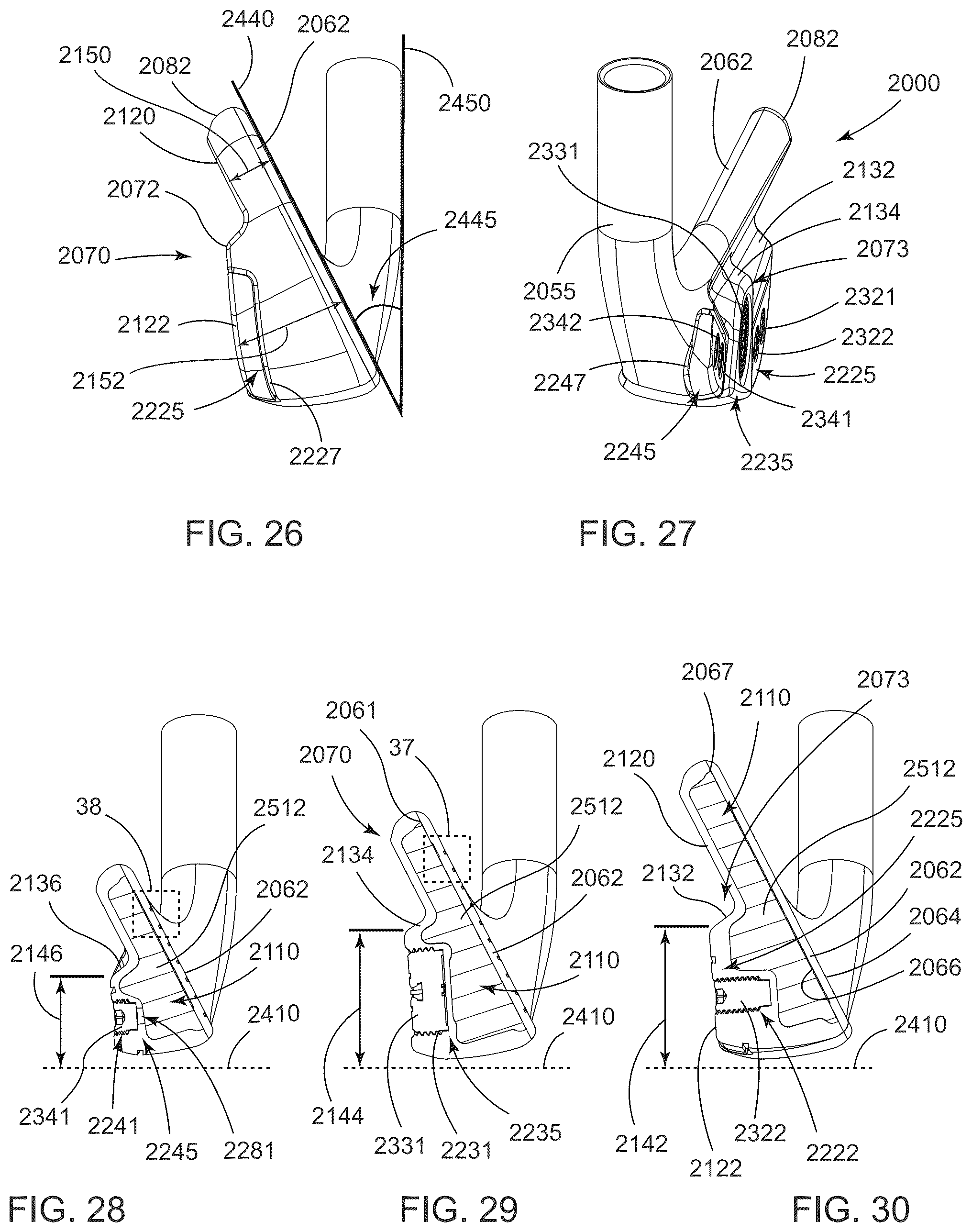 Patent US12324967 Figure 11 – Golf club heads and methods to manufacture golf club heads