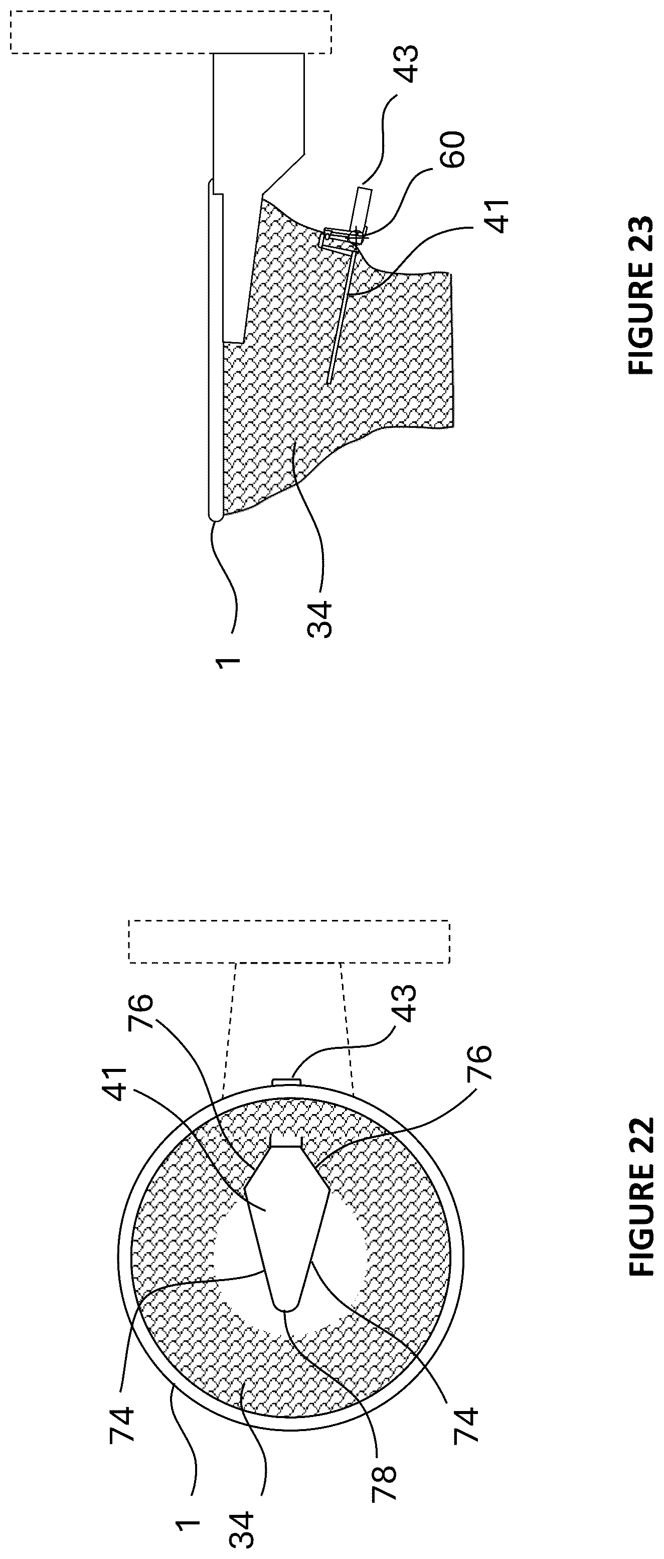 Patent US12324970 Figure 10 – Basketball performance monitoring system