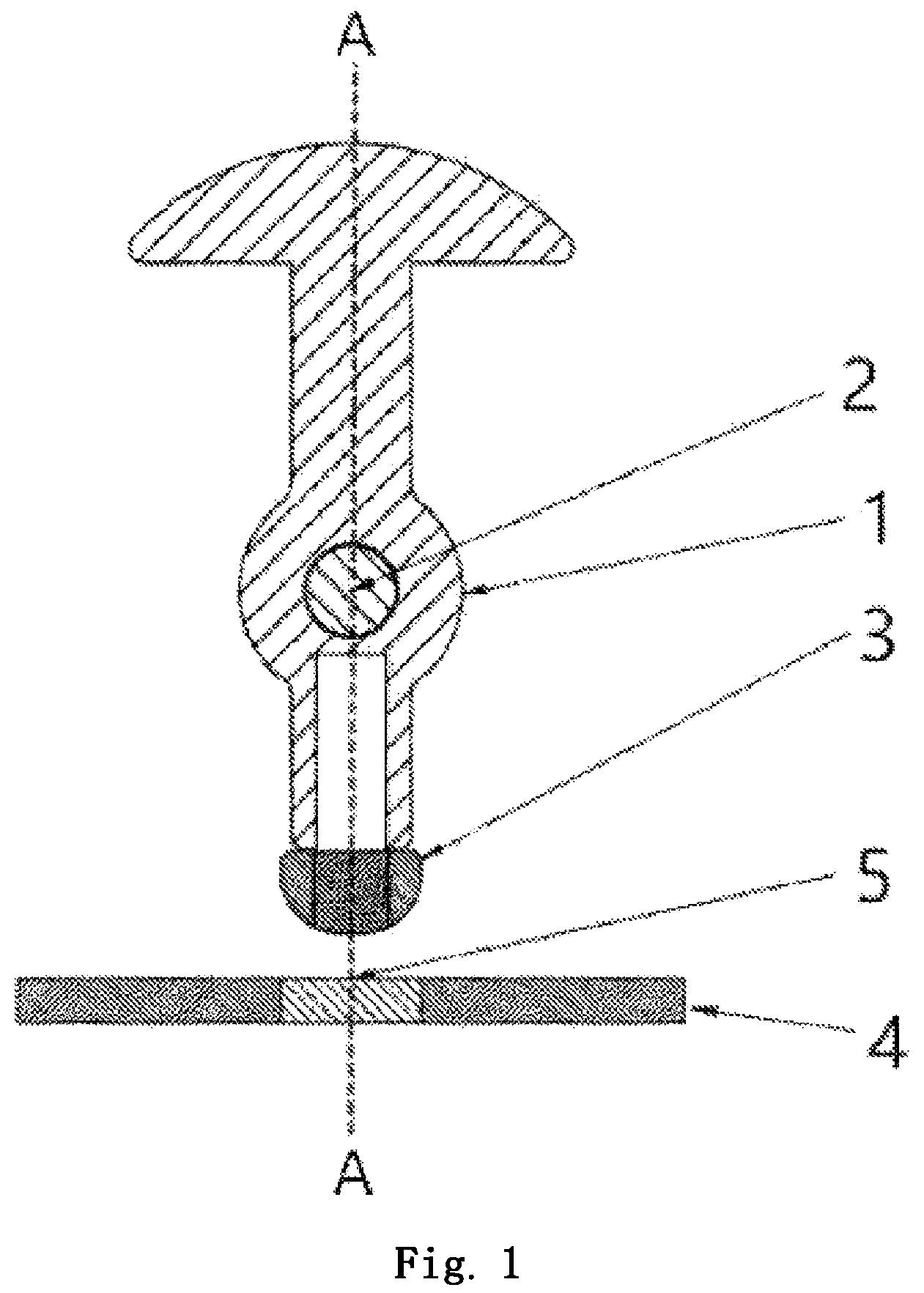 Patent US12324981 — Manipulating device — Figure 1