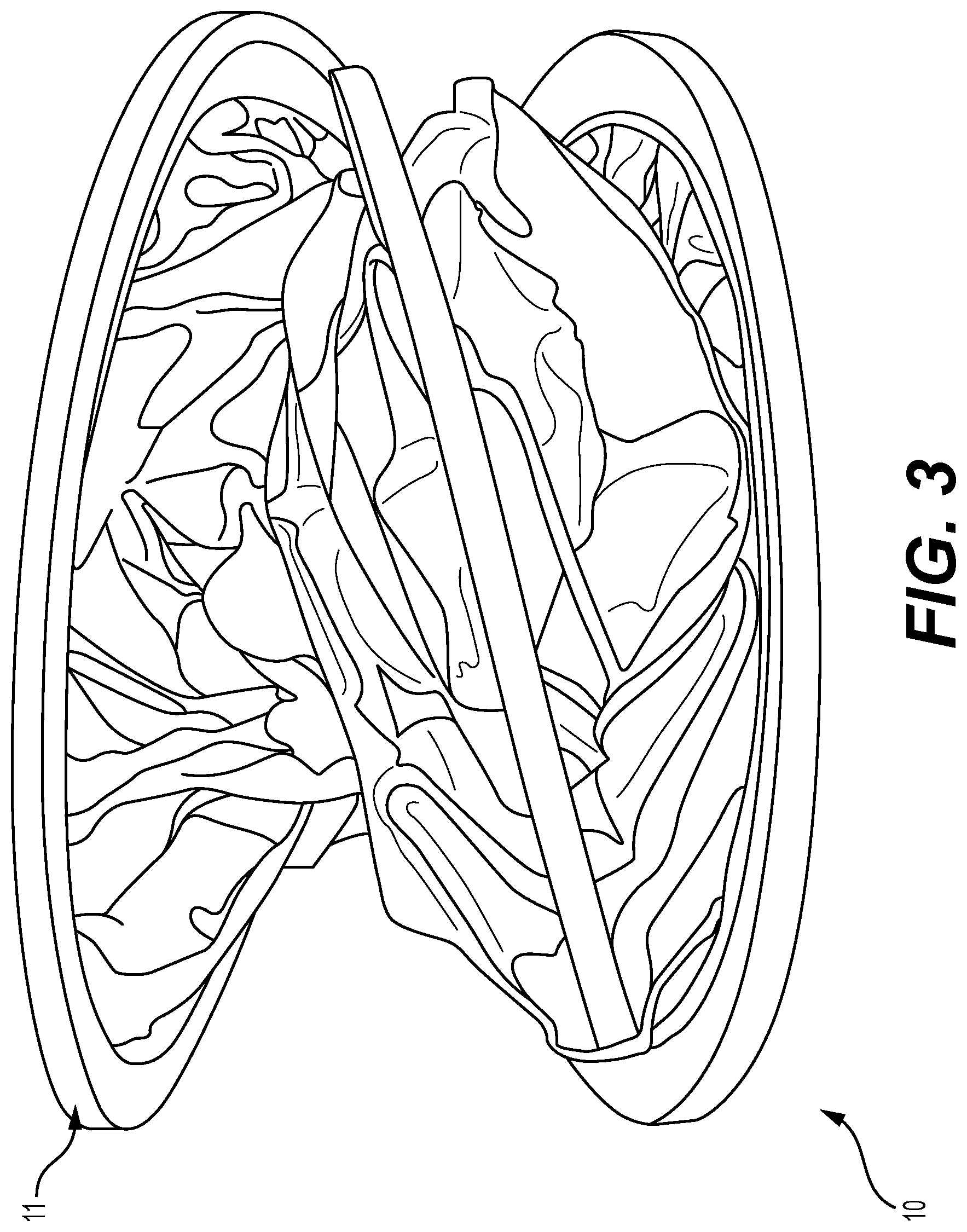 Patent US12325293 Figure 3 – Tire sun shield