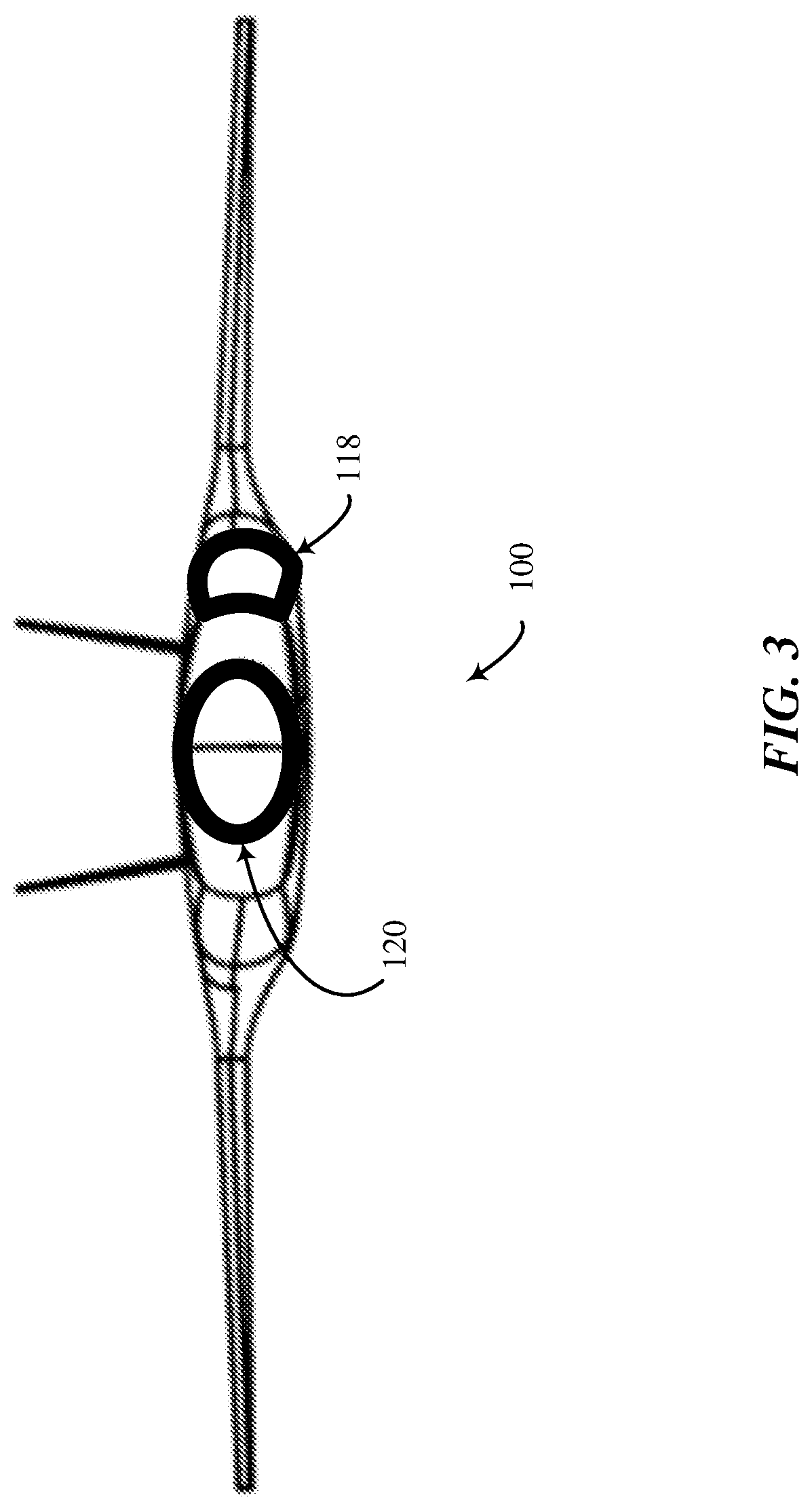 Patent US12325507 Figure 3 – Cargo-bay layout for blended-wing-body aircraft