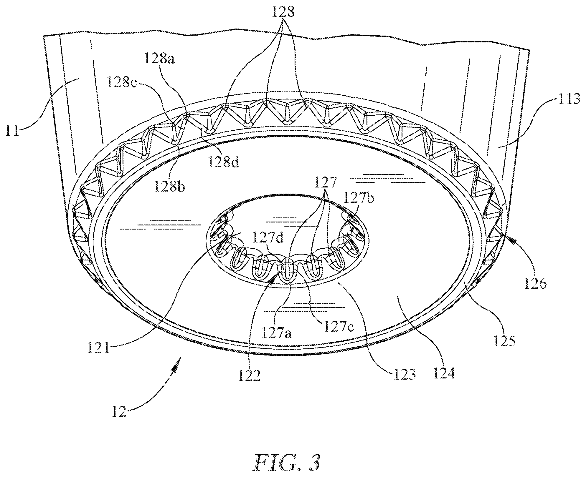 Patent US12325579 Figure 3 – Beverage capsule cup with enhanced material distribution