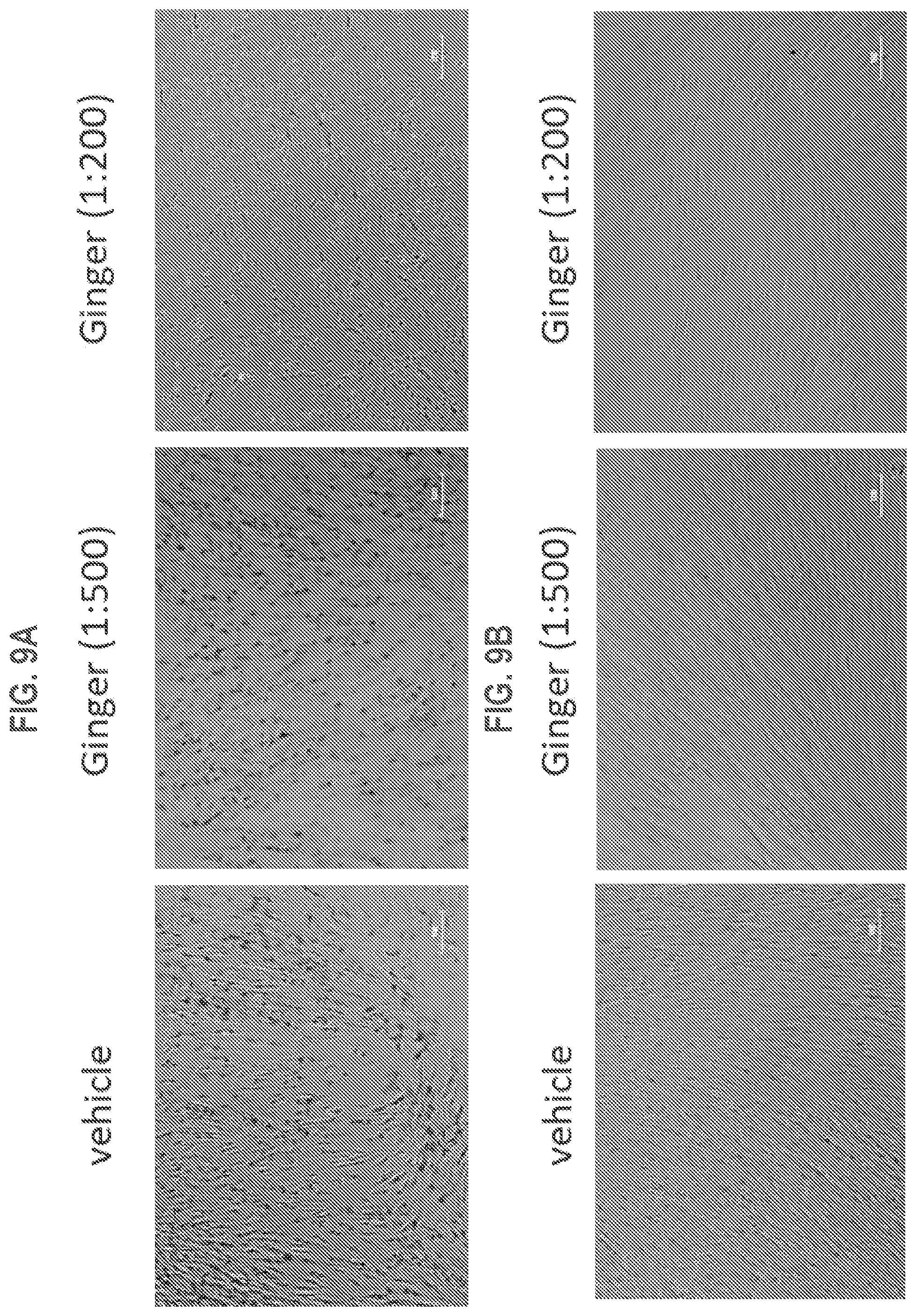 Patent US12325688 Figure 11 – Gingerenone A prodrugs as sensotherapeutics and methods of use