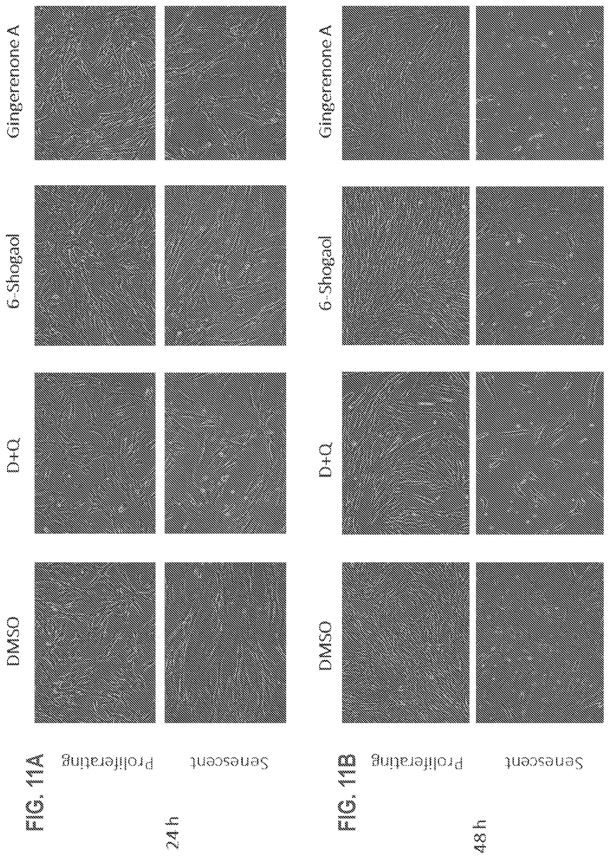 Patent US12325688 Figure 14 – Gingerenone A prodrugs as sensotherapeutics and methods of use