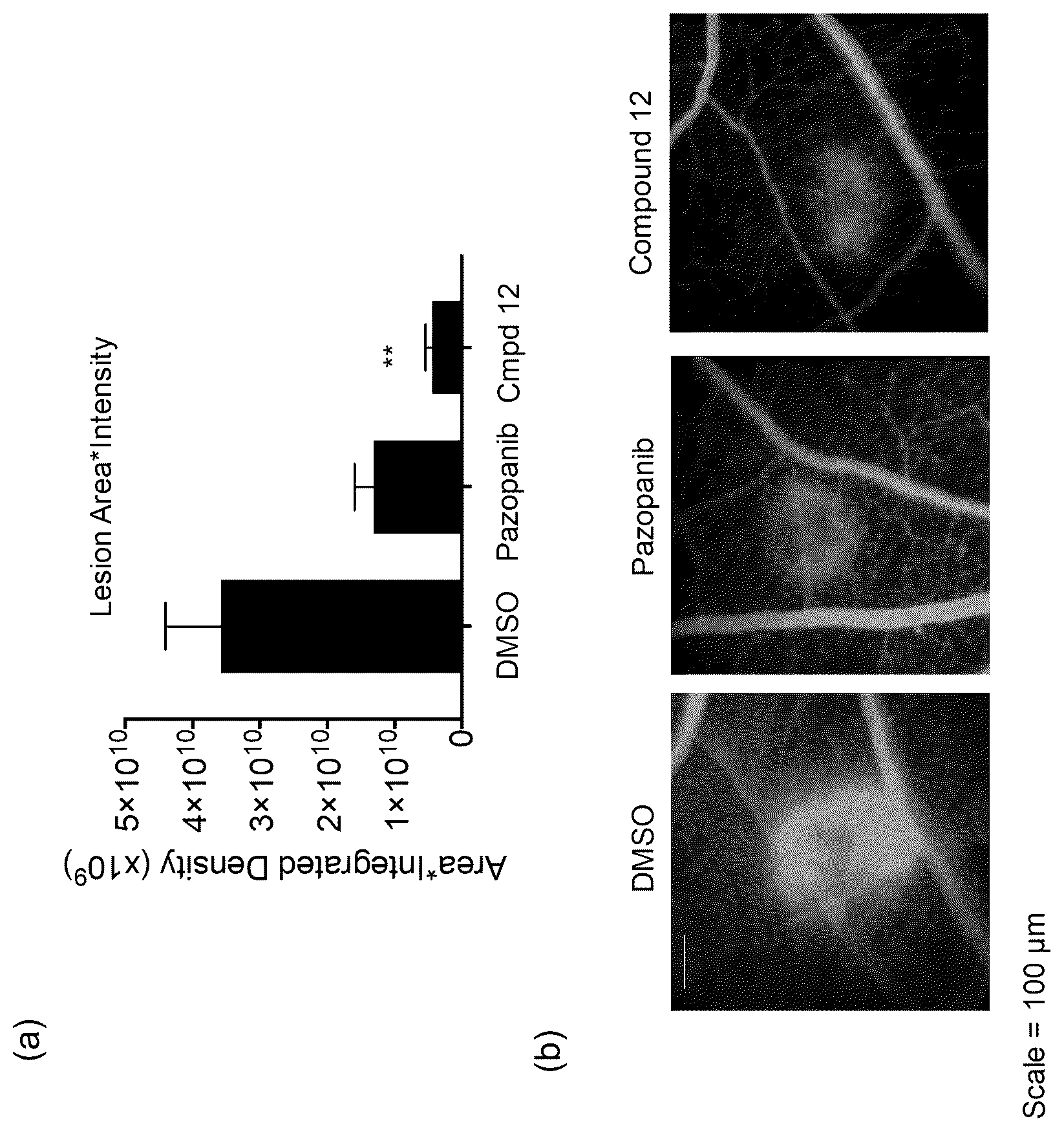 Patent US12325704 — SRPK1 inhibitors — Figure 1