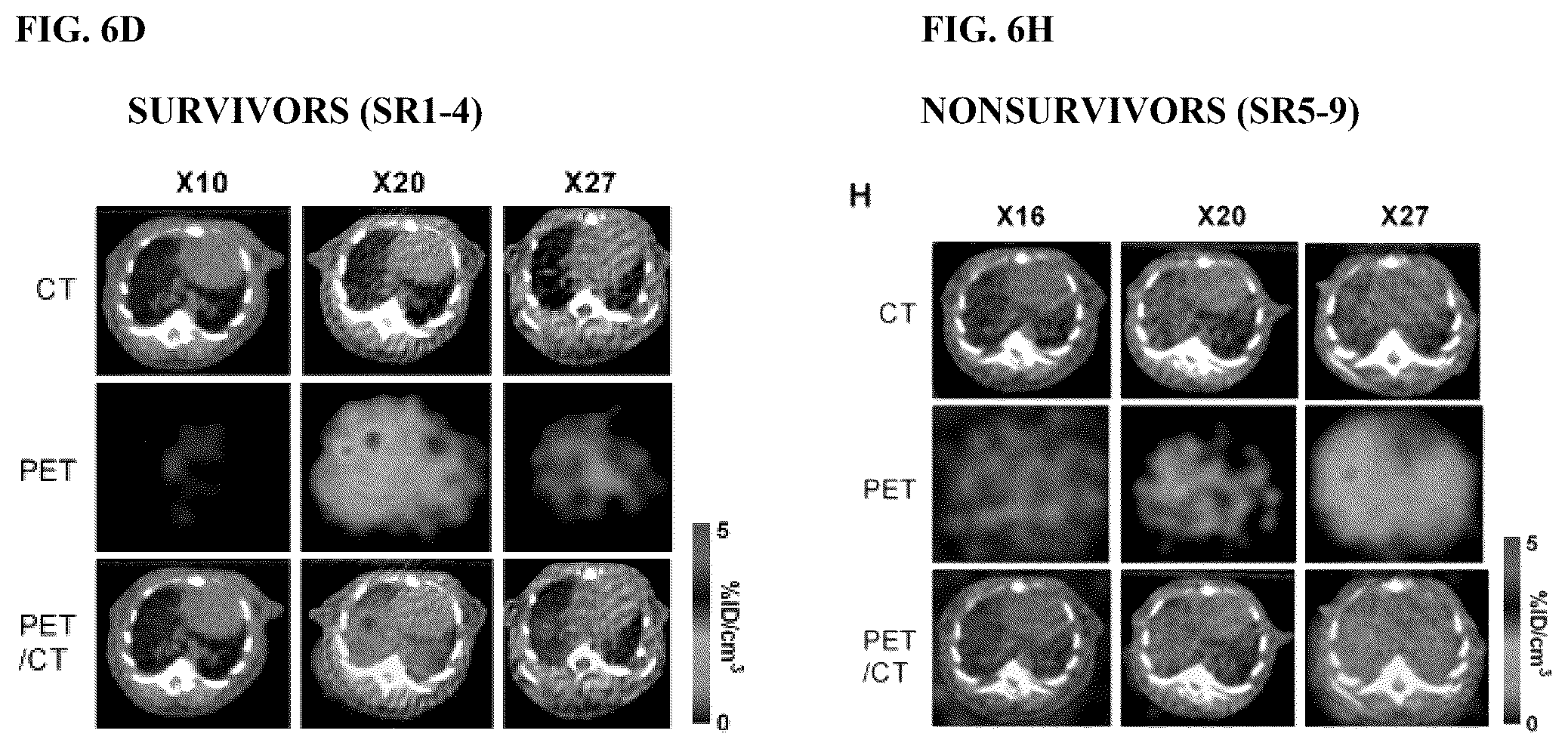 Patent US12325736 Figure 11 – Transduced T cells expressing human SSTR2 and application thereof