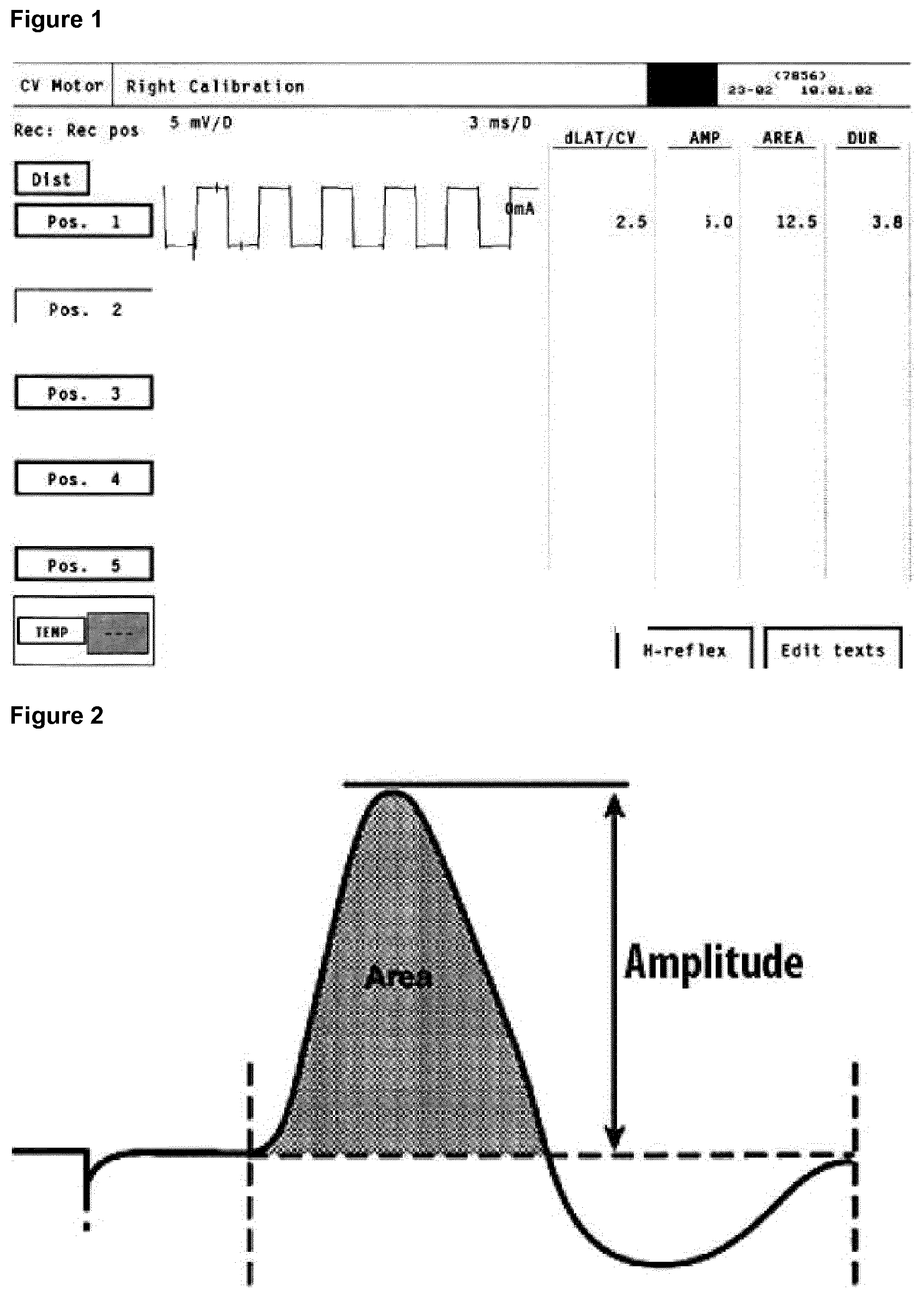 Patent US12325738 Figure 1 – Treatment of CIDP