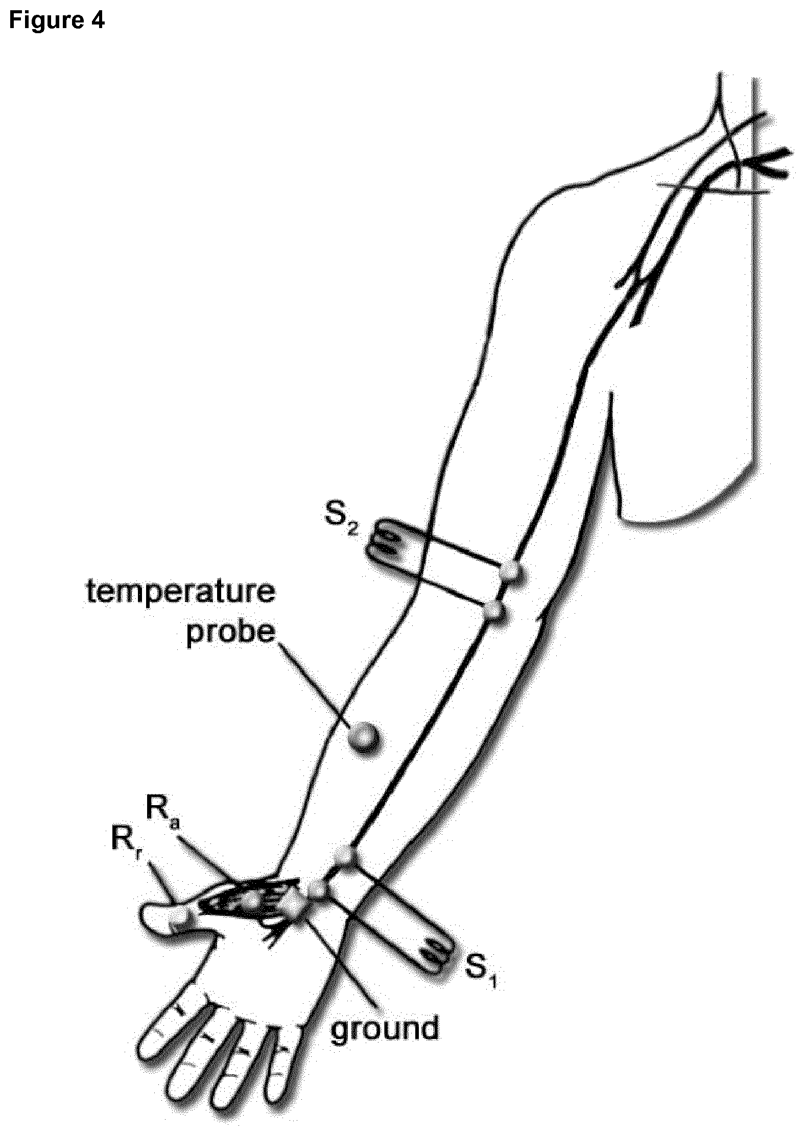 Patent US12325738 Figure 3 – Treatment of CIDP