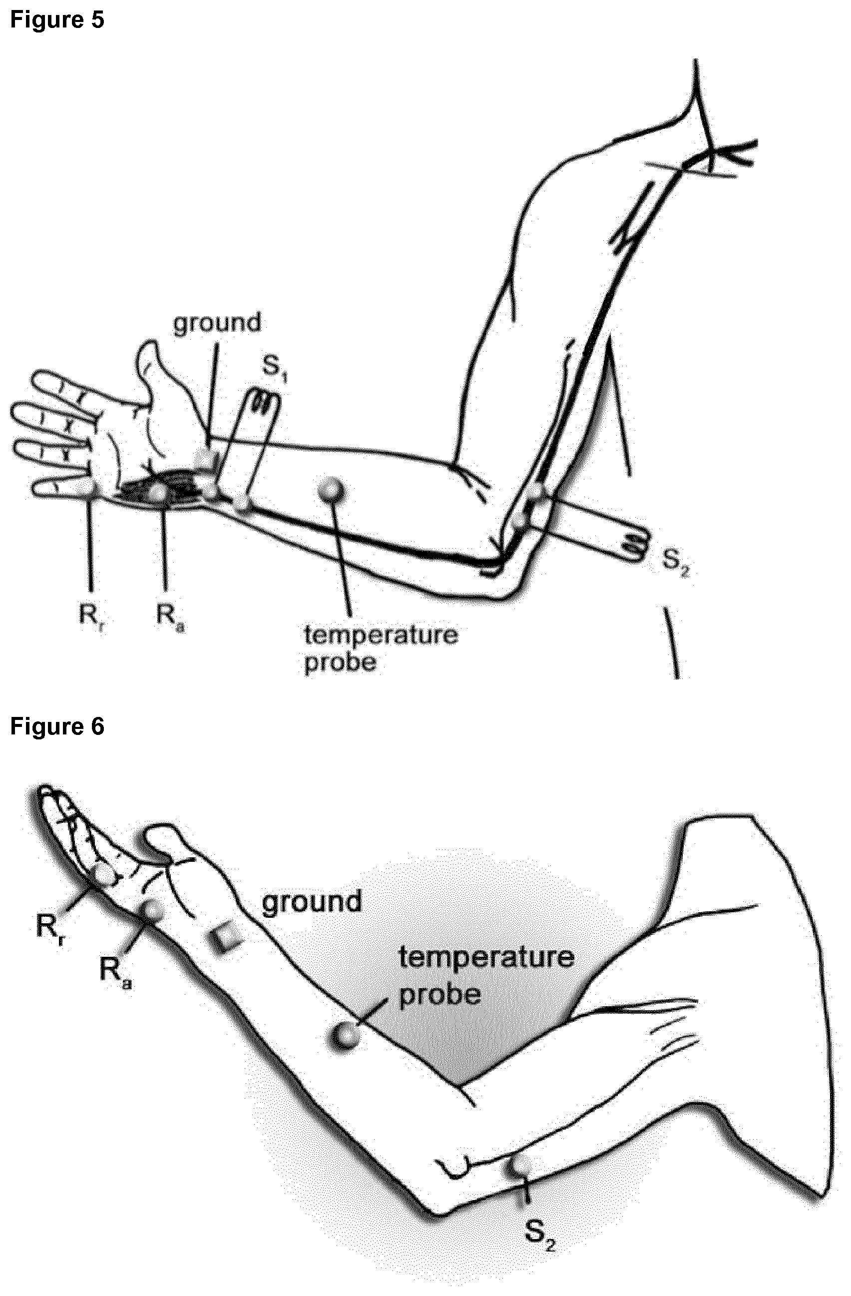 Patent US12325738 Figure 4 – Treatment of CIDP