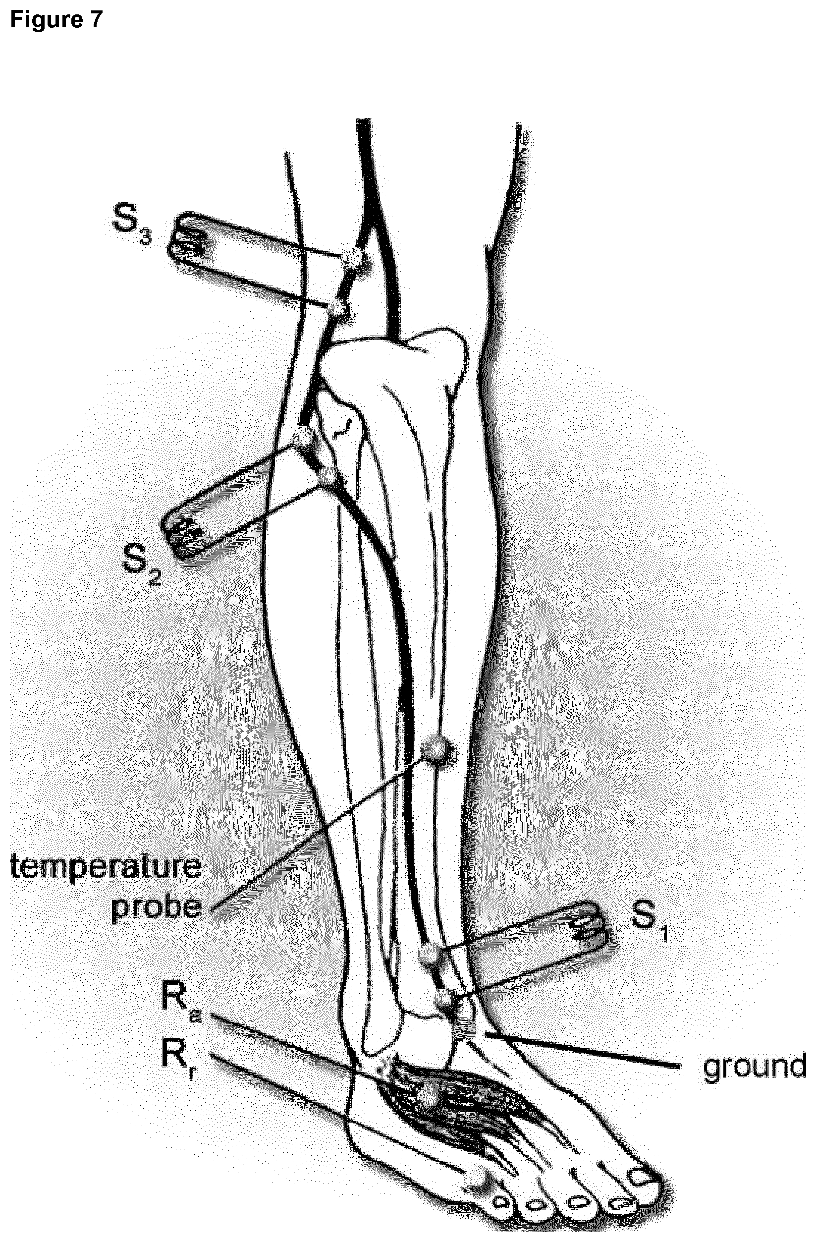 Patent US12325738 Figure 5 – Treatment of CIDP