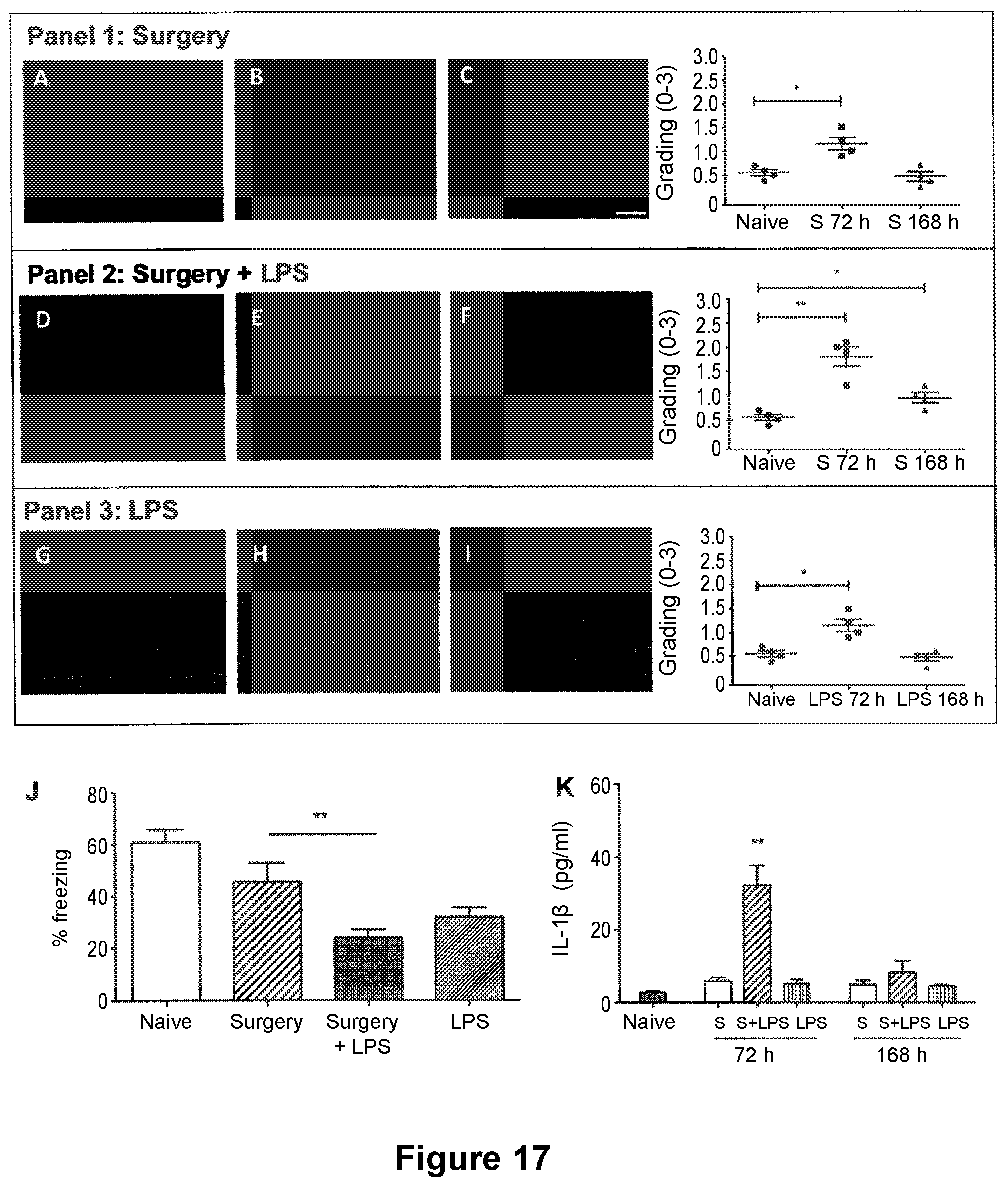 Patent US12325744 Figure 14 – Methods for reducing post-operative cognitive dysfunction (POCD)