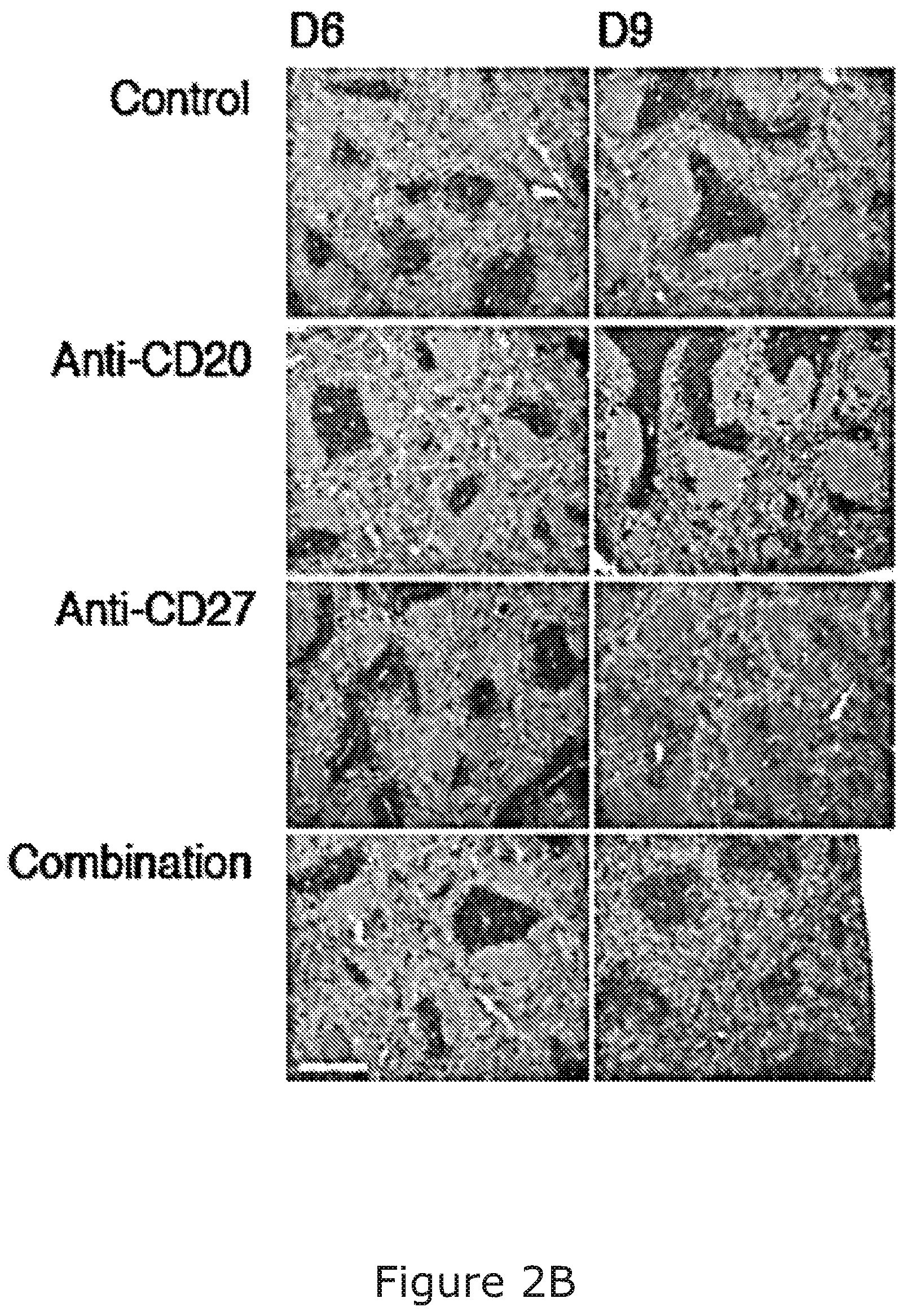 Patent US12325754 Figure 3 – Cancer and B-cell related disease therapy