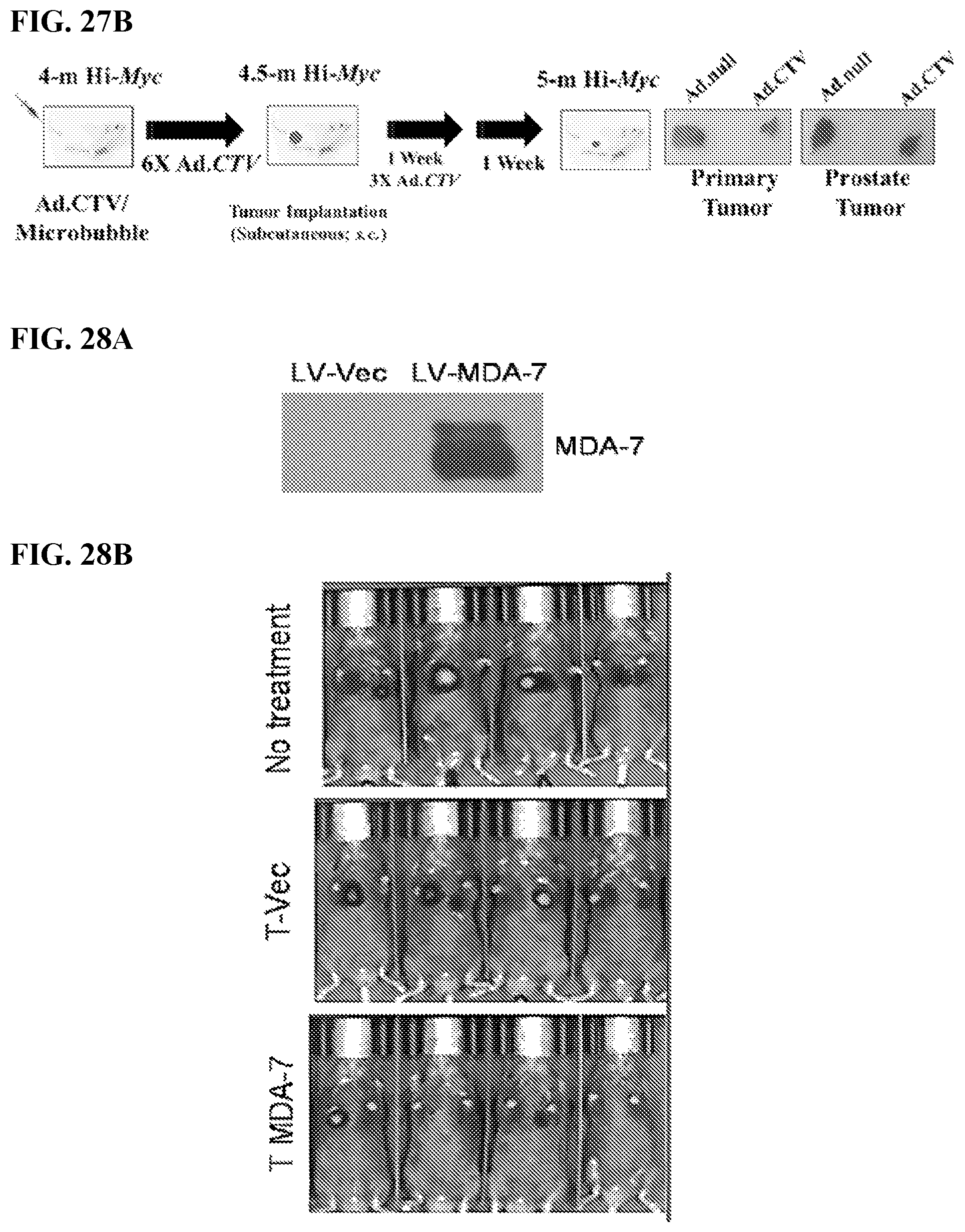 Patent US12325863 Figure 16 – MDA-7/IL-24 secretory variants and methods of use