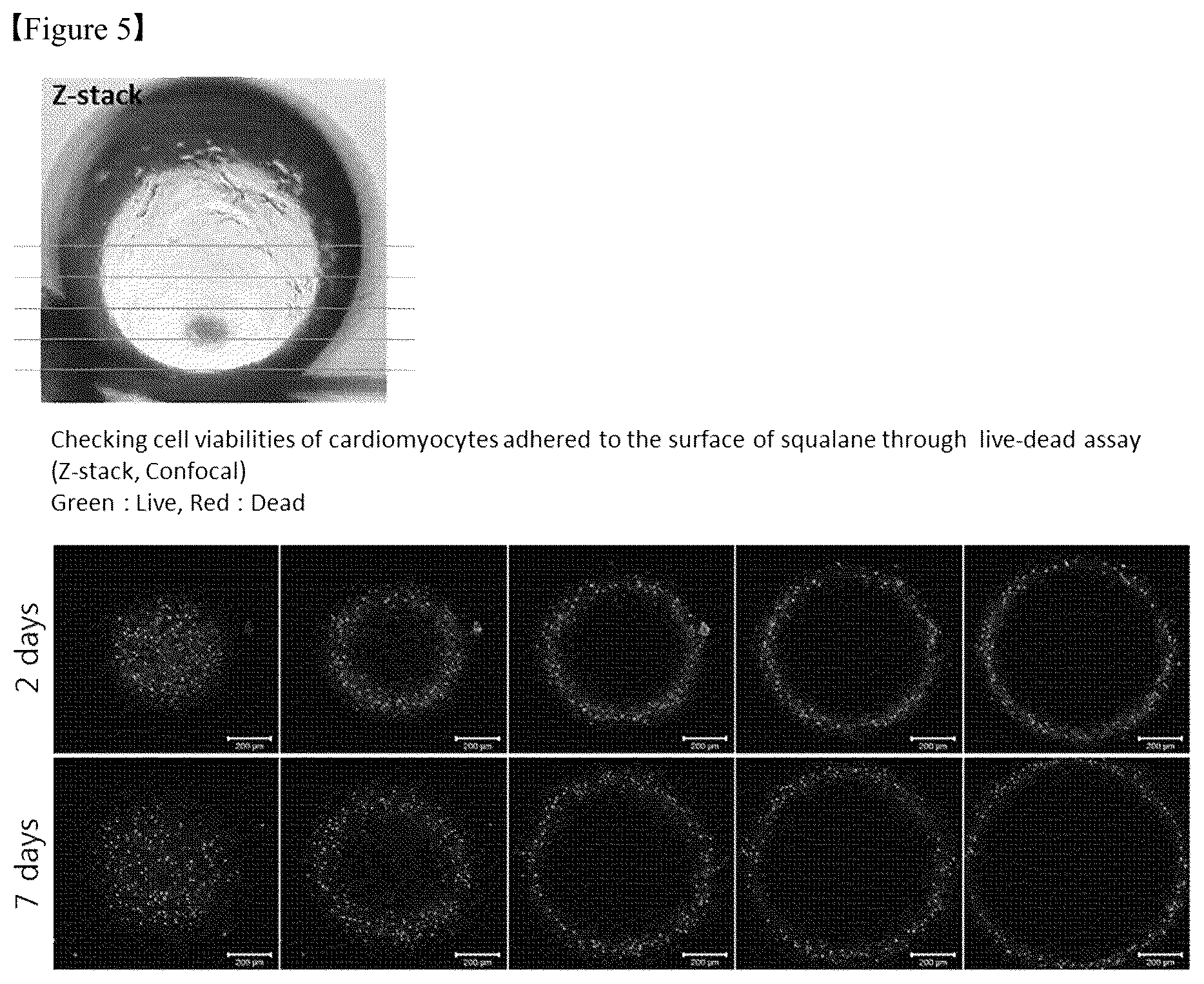 Patent US12325867 Figure 5 – Organoid produced using carrier for cell culture, and method for evaluating drug toxicity using same