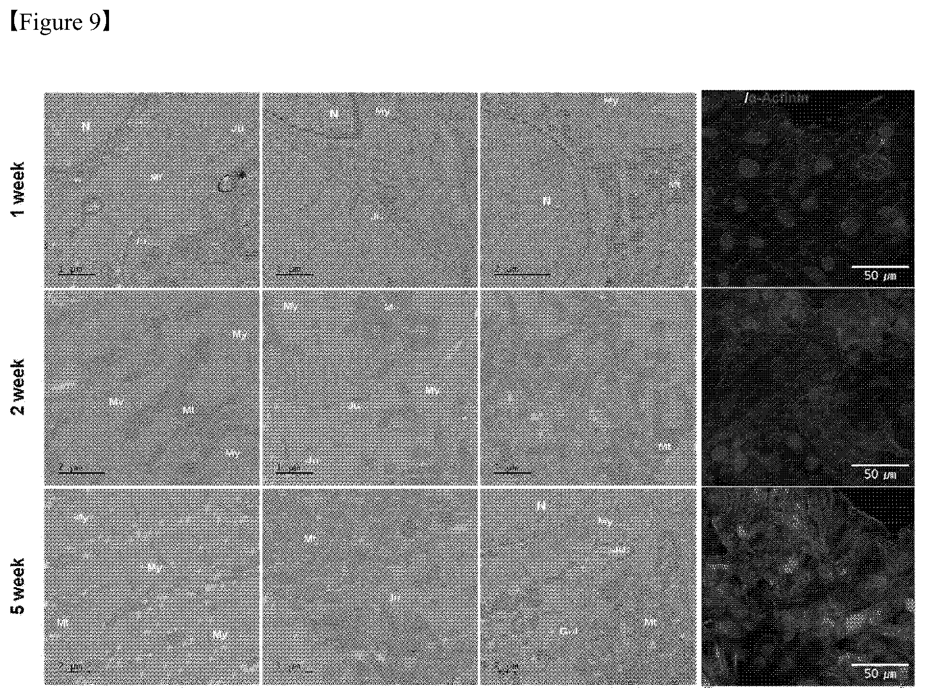 Patent US12325867 Figure 9 – Organoid produced using carrier for cell culture, and method for evaluating drug toxicity using same