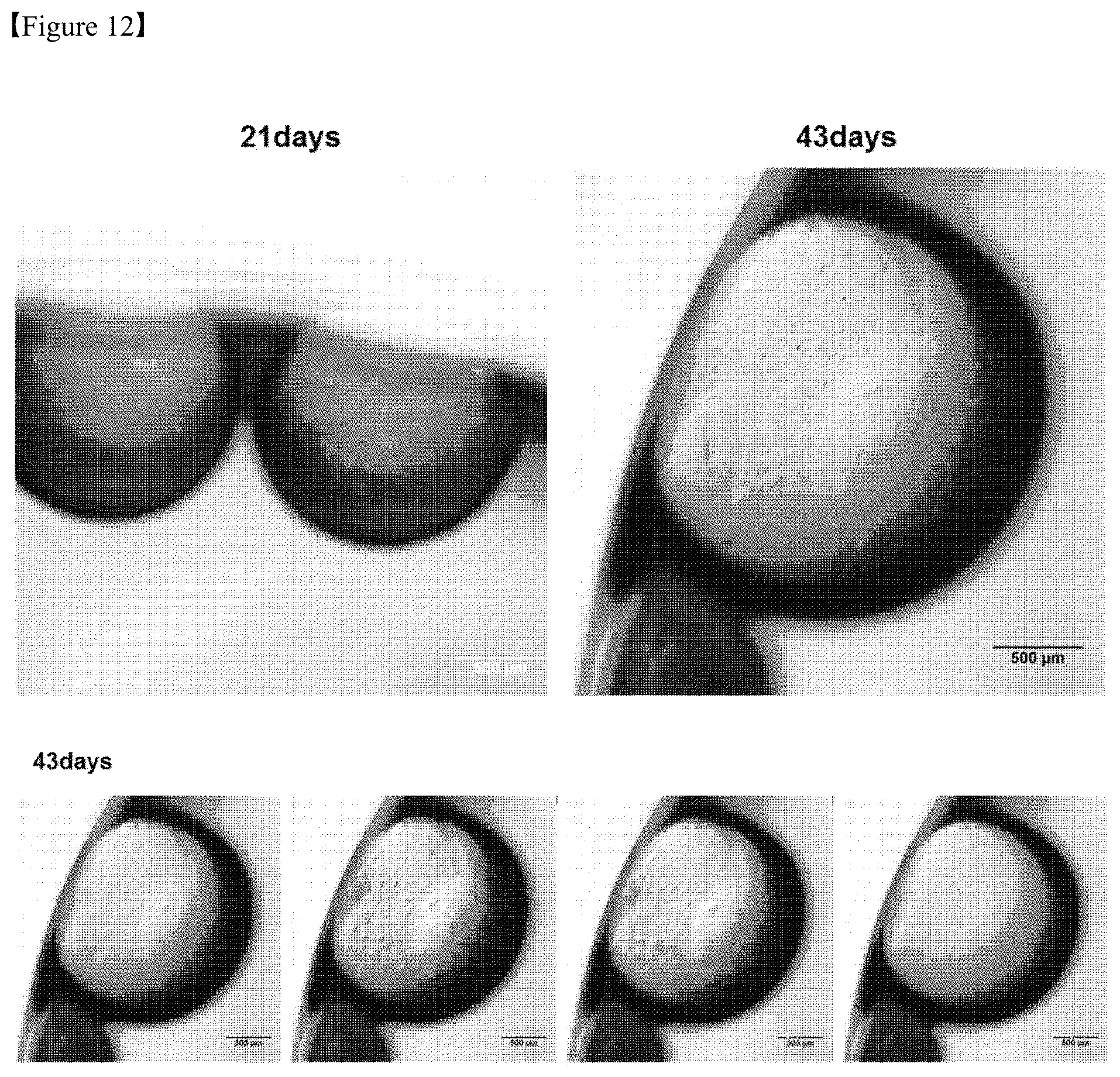 Patent US12325867 Figure 12 – Organoid produced using carrier for cell culture, and method for evaluating drug toxicity using same