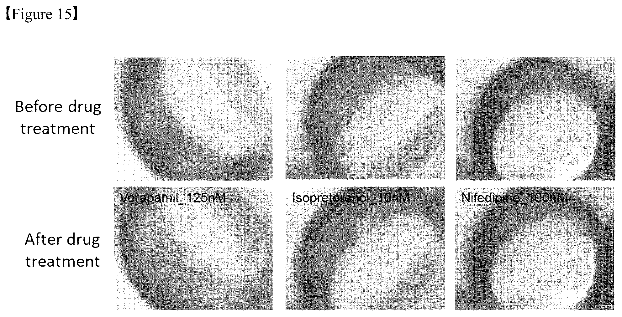 Patent US12325867 Figure 15 – Organoid produced using carrier for cell culture, and method for evaluating drug toxicity using same