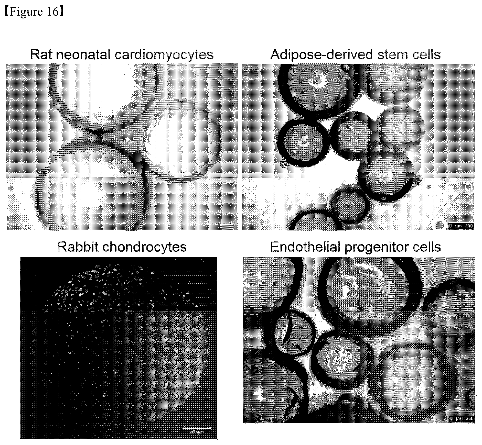 Patent US12325867 Figure 16 – Organoid produced using carrier for cell culture, and method for evaluating drug toxicity using same
