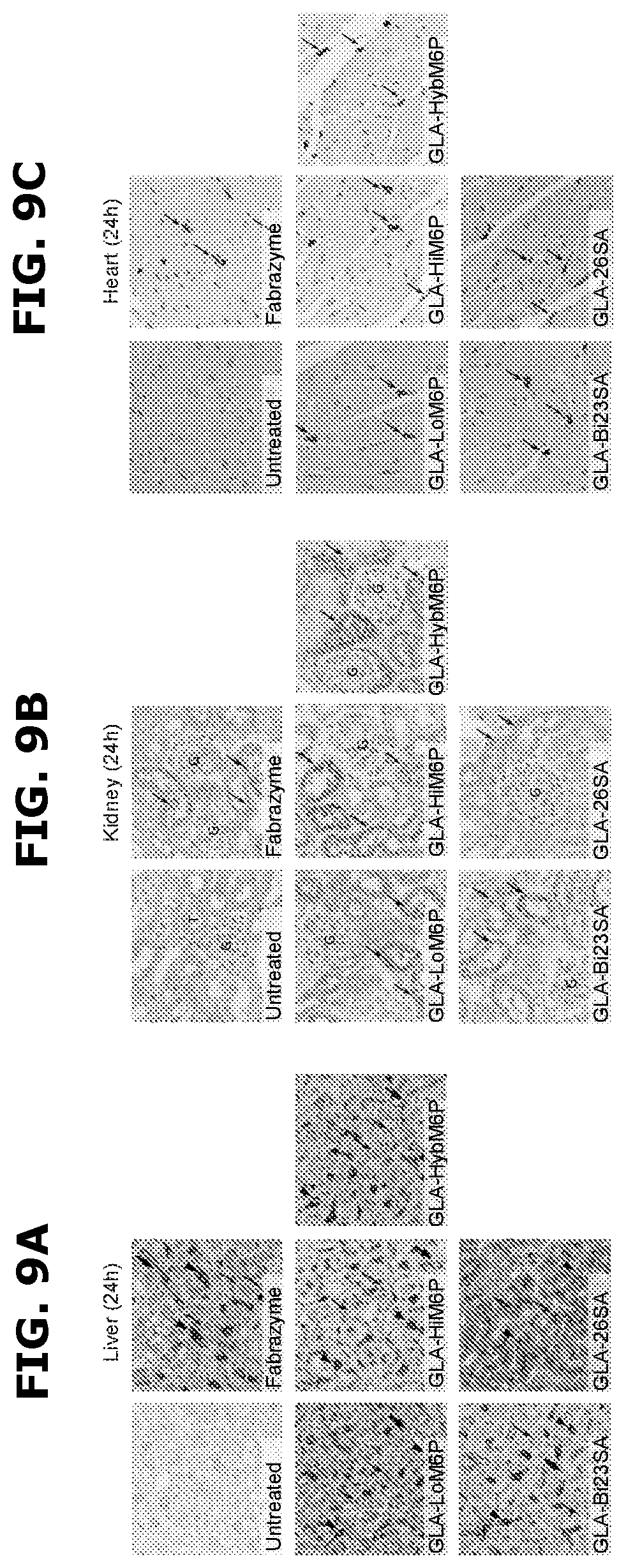 Patent US12325871 Figure 8 – Lysosomal enzymes modified by cell based glycoengineering