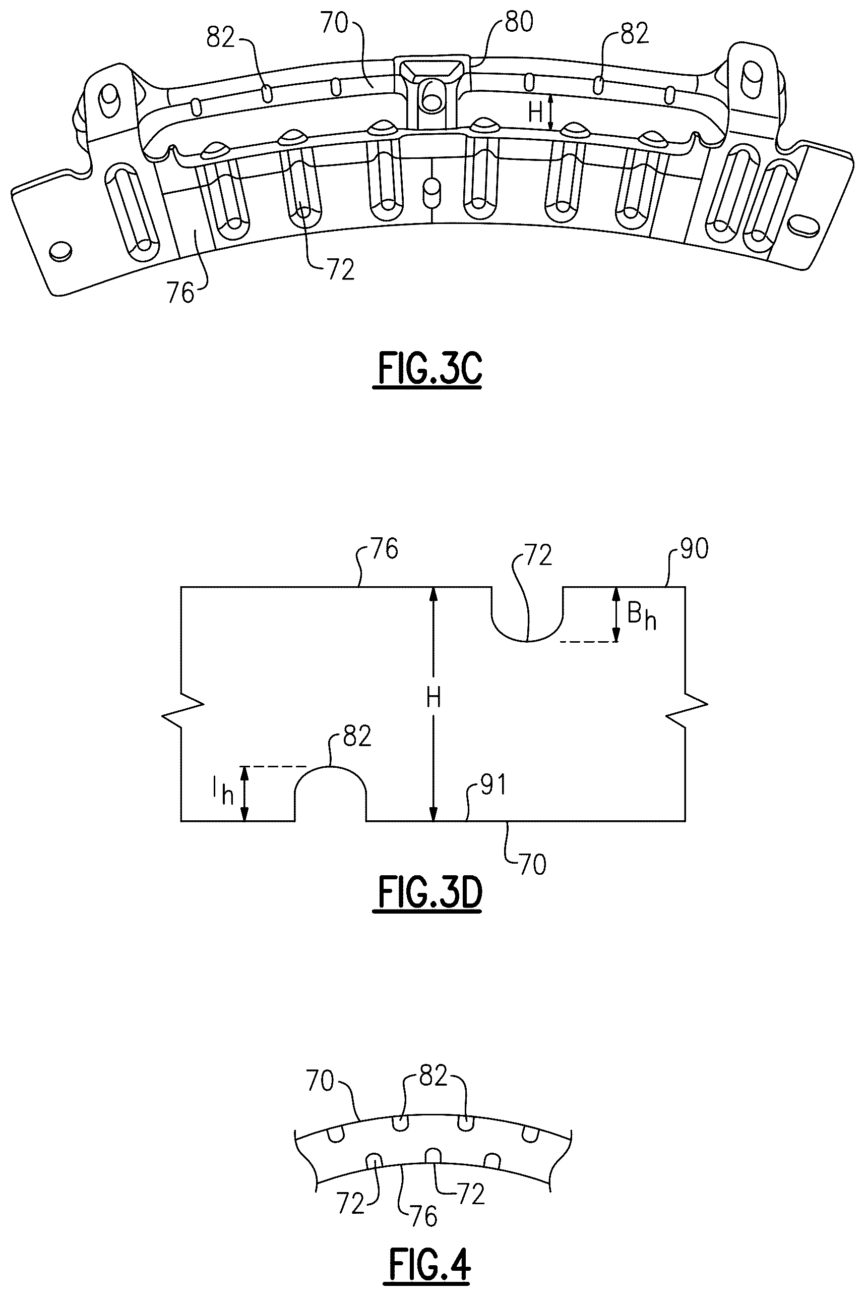 Patent US12326112 Figure 4 – Gas turbine engine bypass louver and baffle rib design