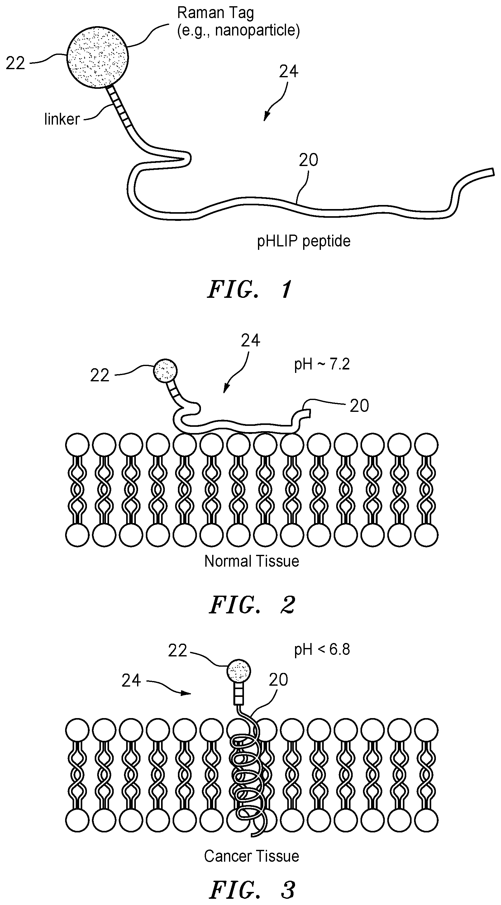 Patent US12326404 Figure 1 – Method and system for detecting cancerous tissue and tumor margin using raman spectroscopy