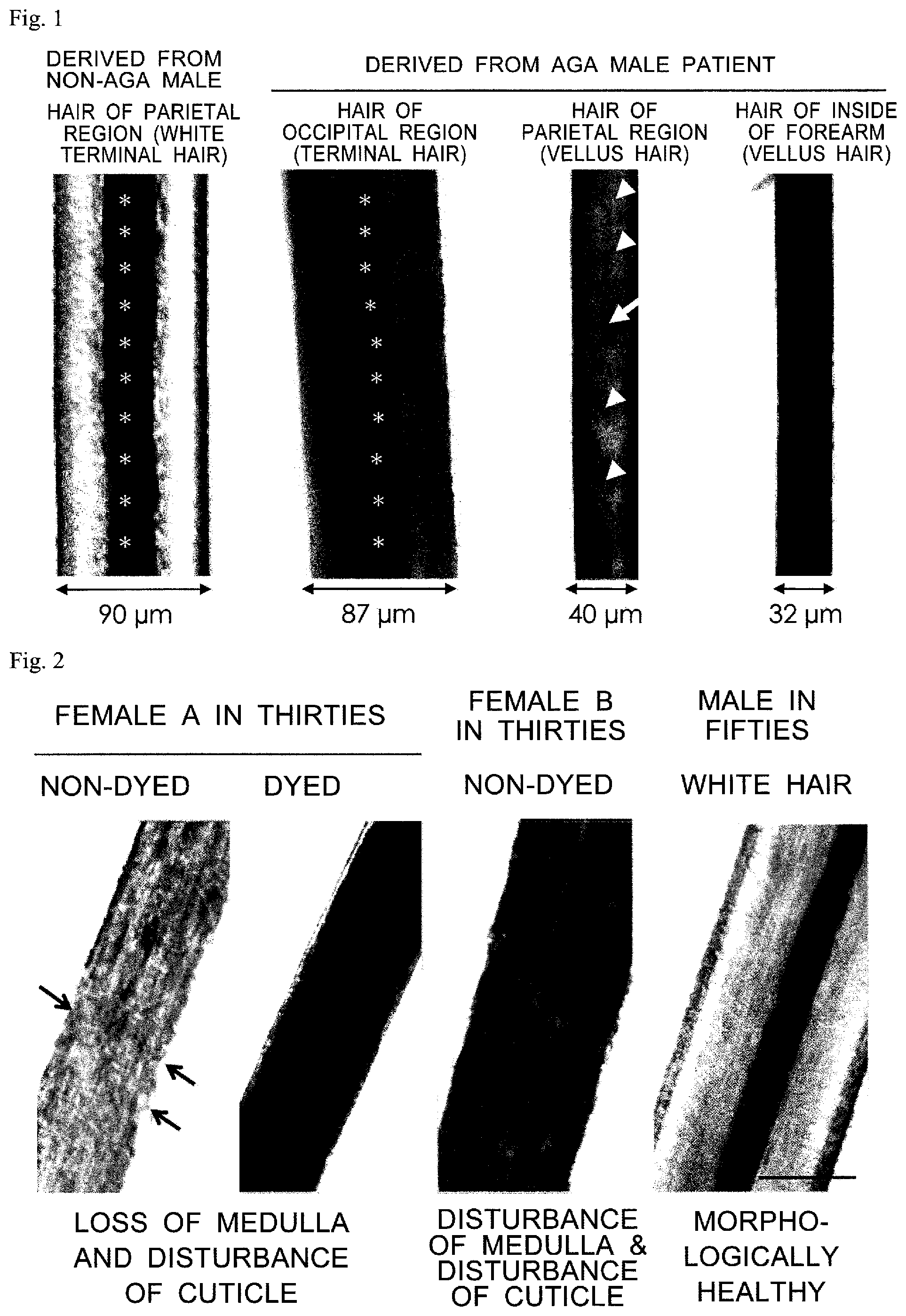 Patent US12326438 Figure 1 – Health-level measuring method, health-level determining apparatus, and hair-health examination system