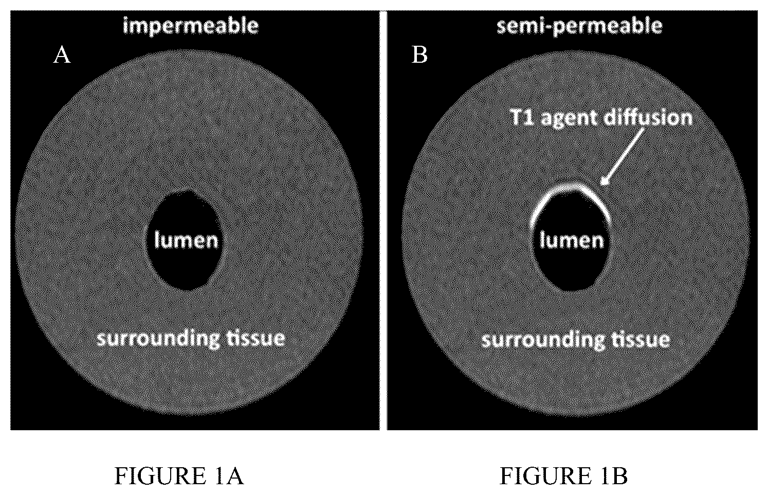 Patent US12326492 Figure 1 – Systems and methods of detecting interstitial cystitis