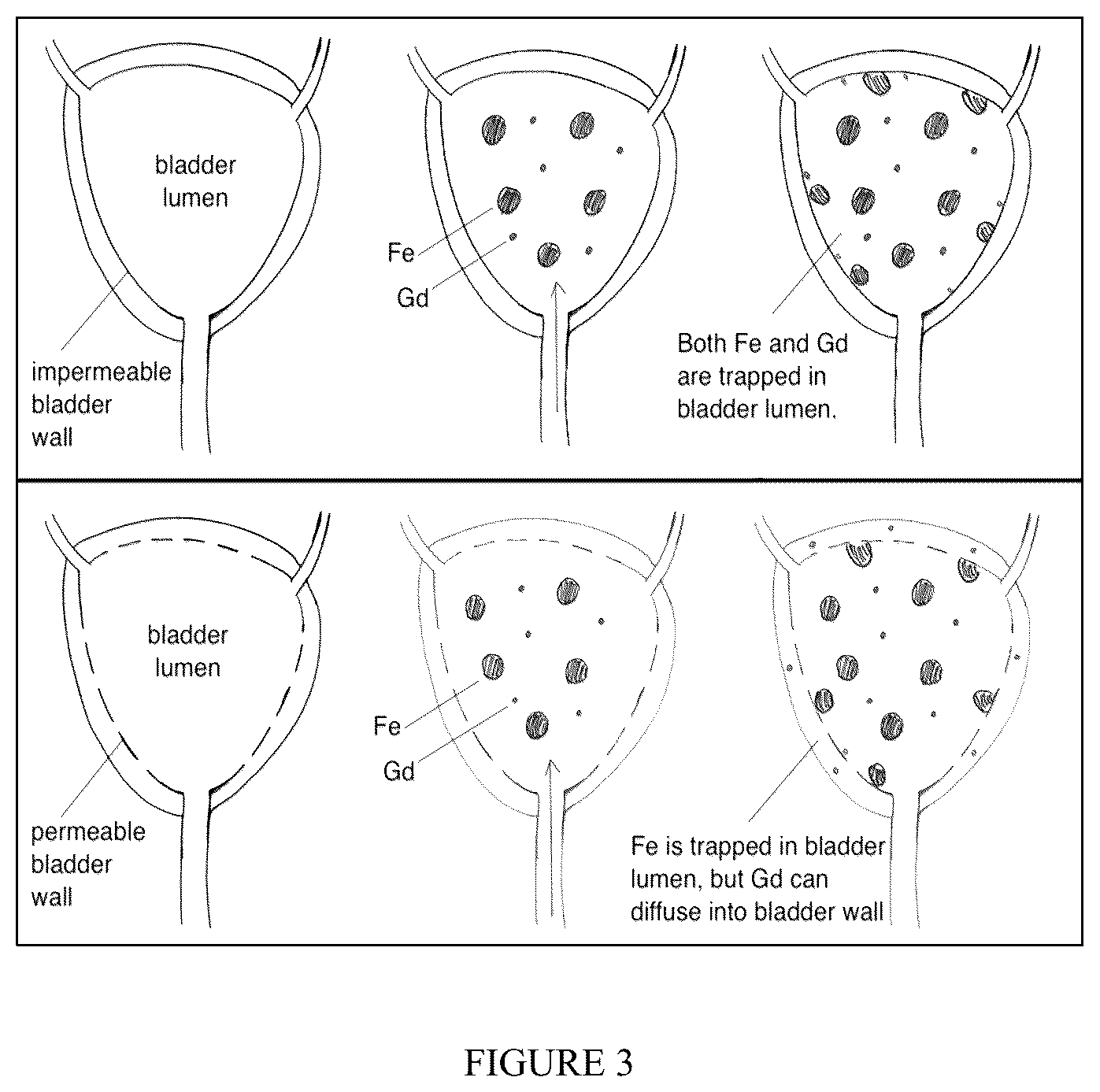 Patent US12326492 Figure 3 – Systems and methods of detecting interstitial cystitis