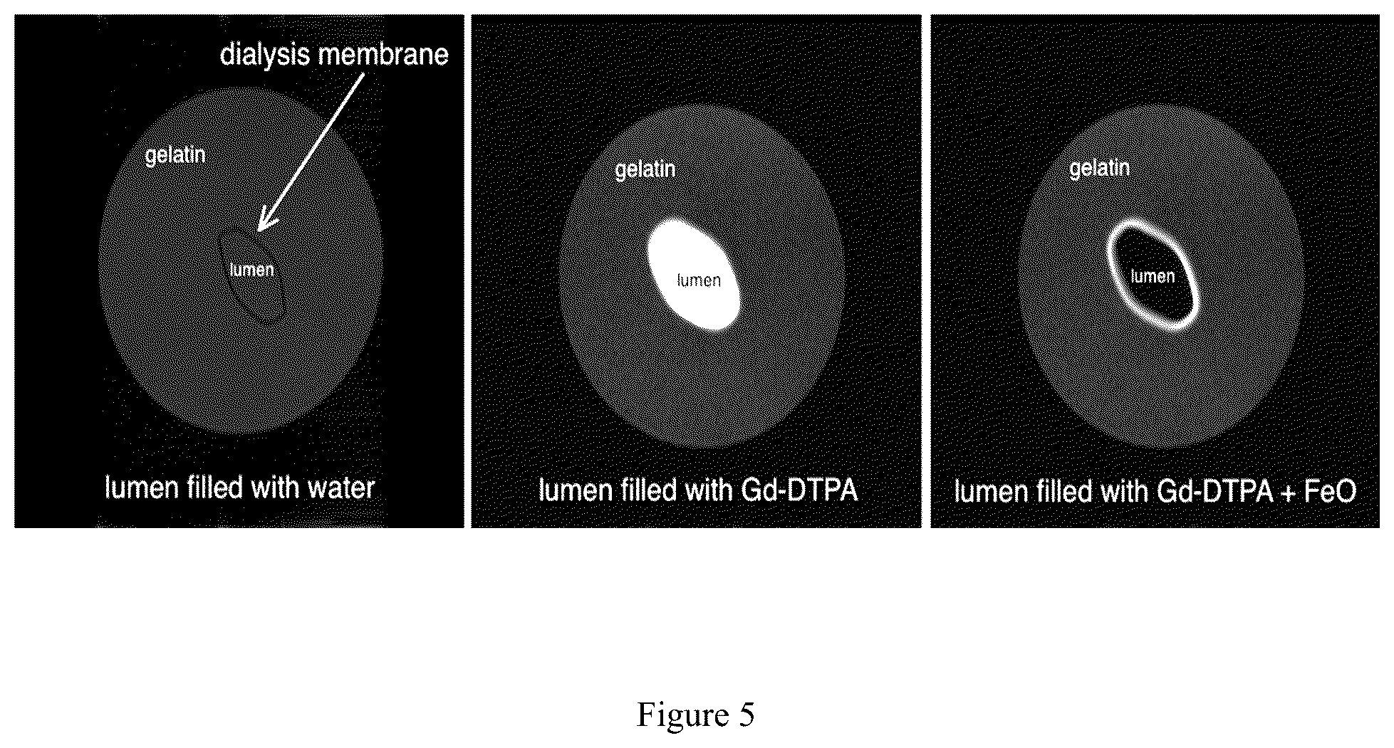 Patent US12326492 Figure 5 – Systems and methods of detecting interstitial cystitis