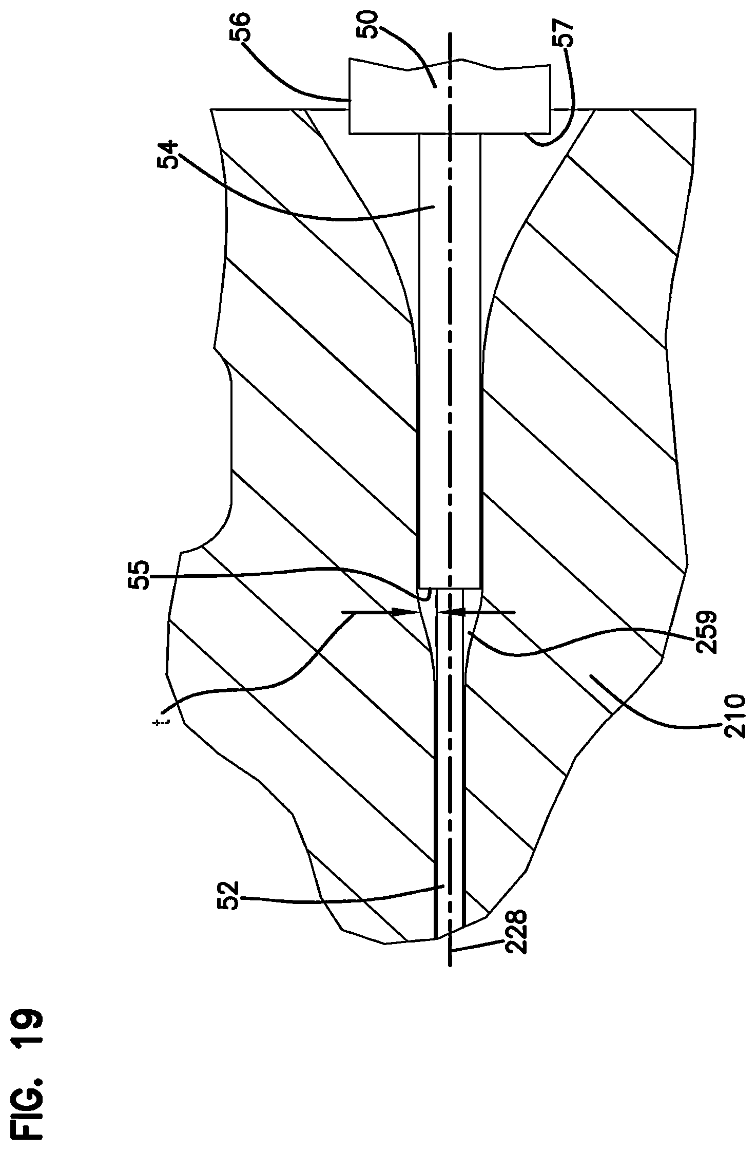Patent US12326598 Figure 14 – Cable and dual inner diameter ferrule device with smooth internal contours and method