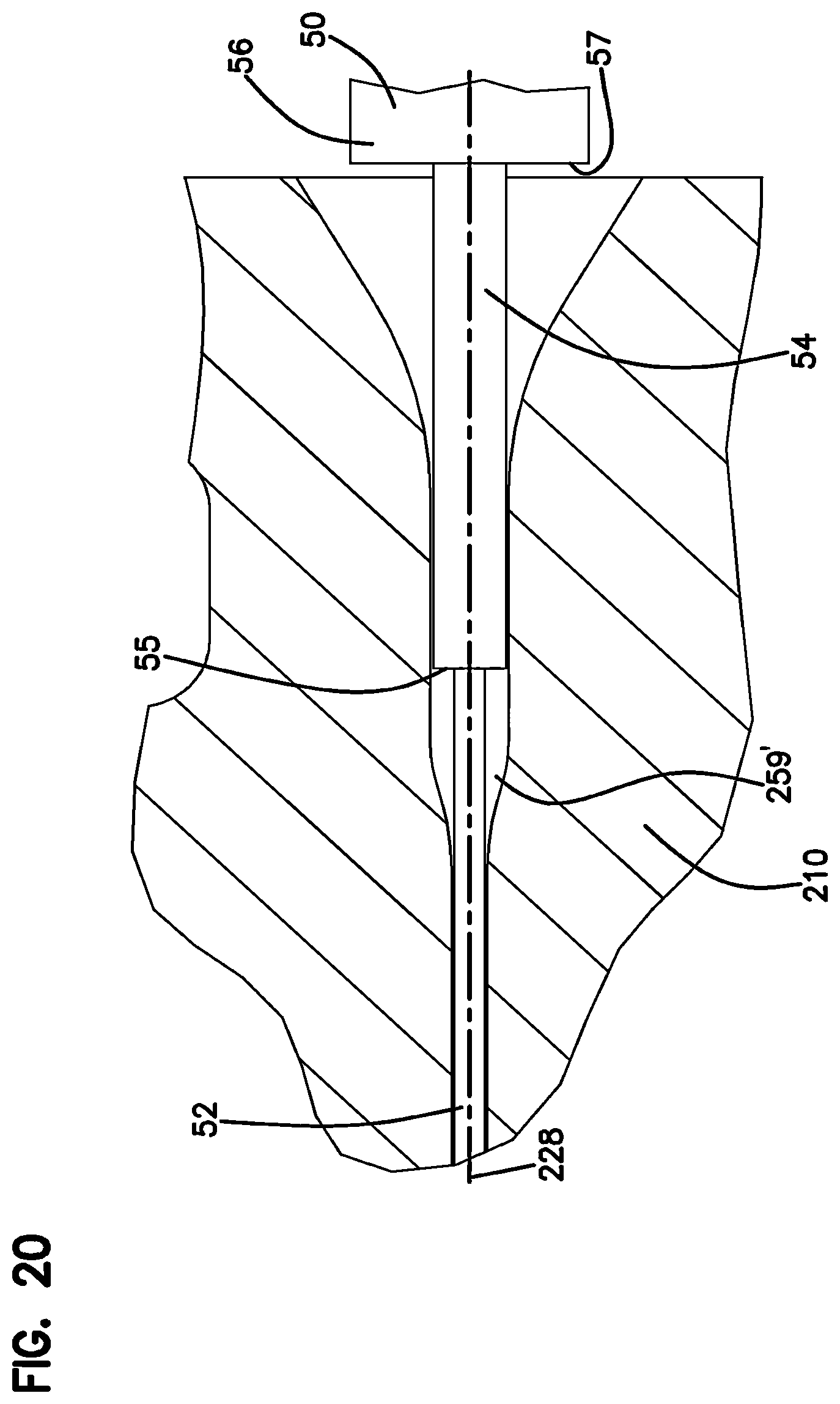 Patent US12326598 Figure 15 – Cable and dual inner diameter ferrule device with smooth internal contours and method