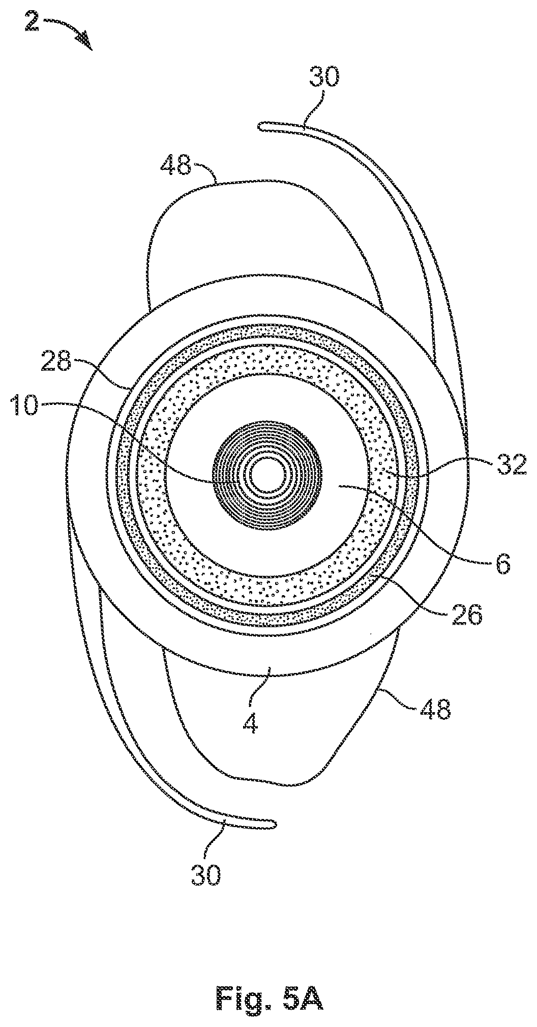 Patent US12326617 Figure 5 – Flexible electro-active lens