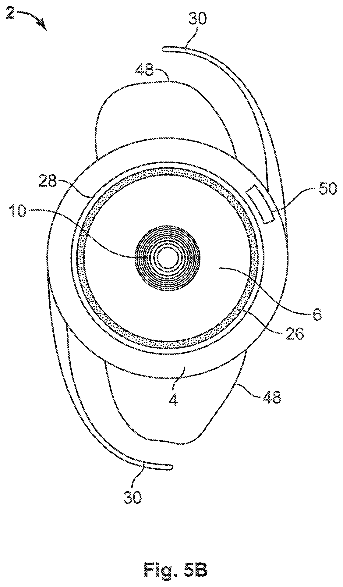 Patent US12326617 Figure 6 – Flexible electro-active lens