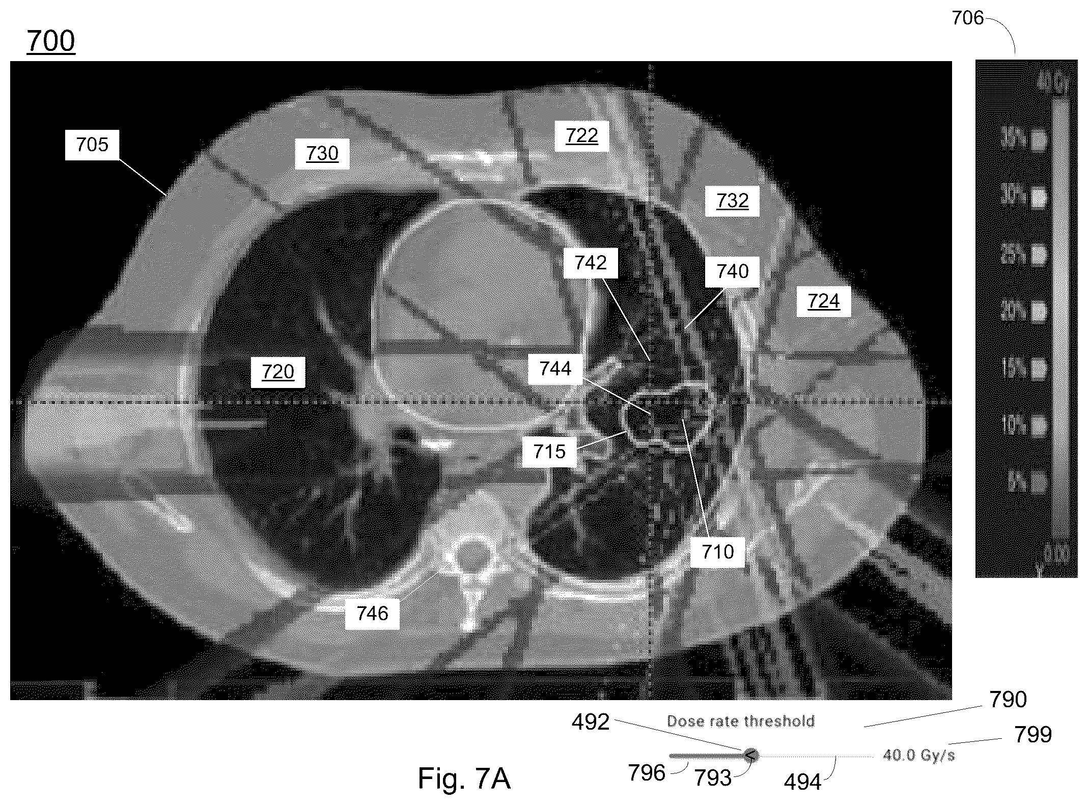 Patent US12327013 Figure 10 – Graphical user interface control device for radiation therapy treatment planning
