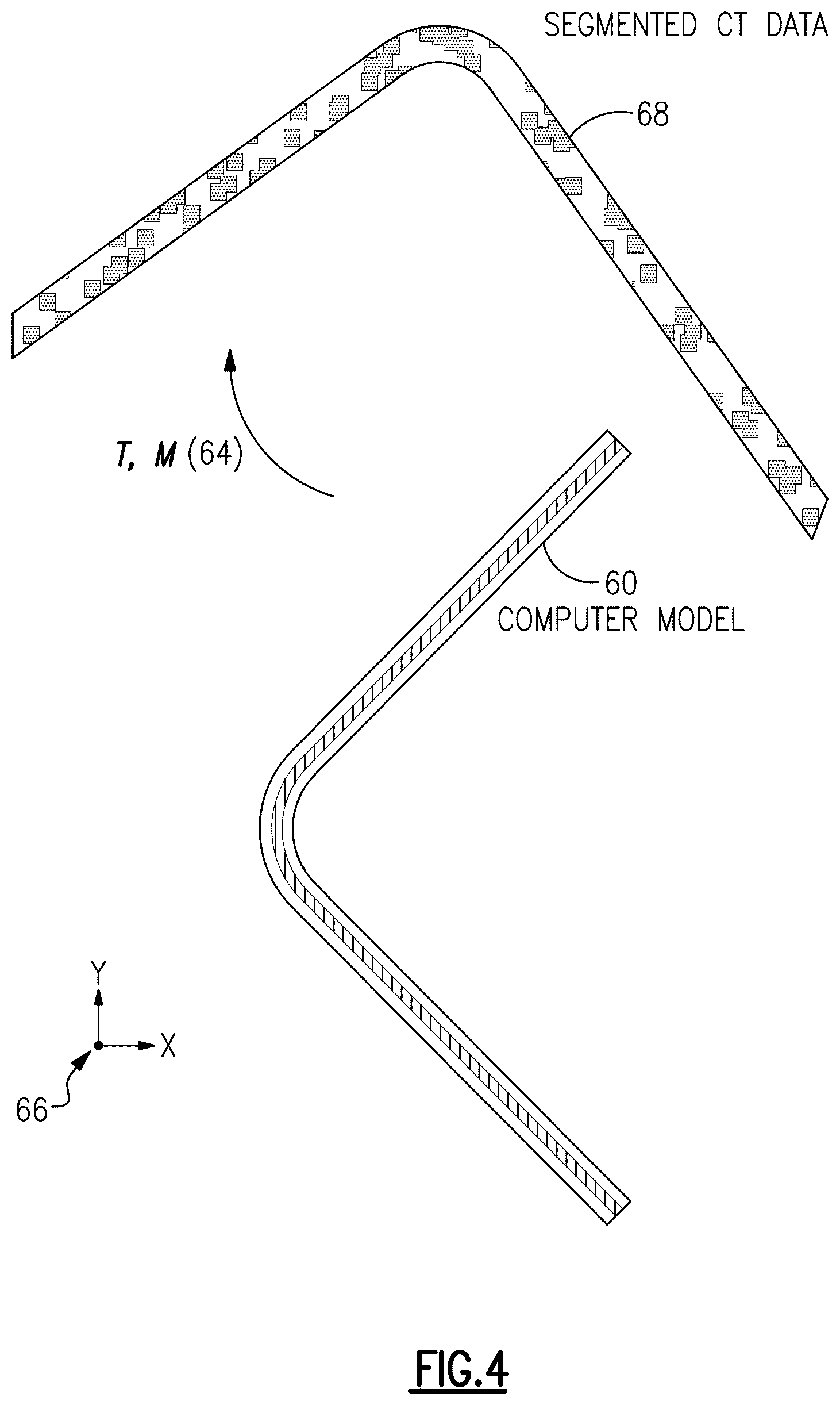 Patent US12327325 Figure 4 – Method and apparatus for analyzing computed tomography data