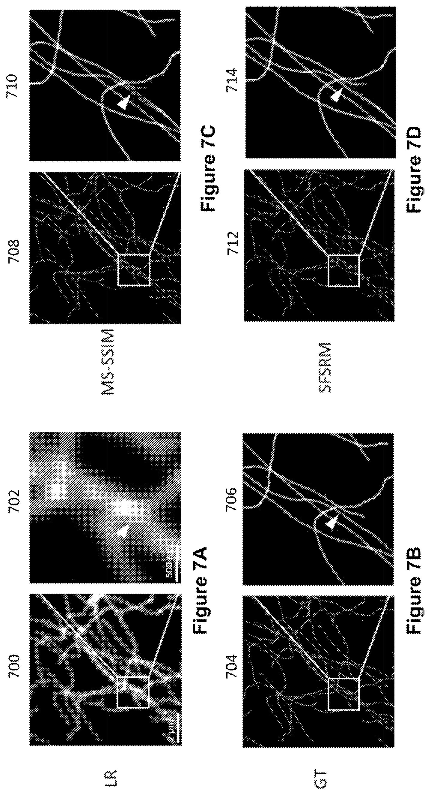 Patent US12327327 Figure 5 – Deep learning based single frame super resolution microscopy image processing