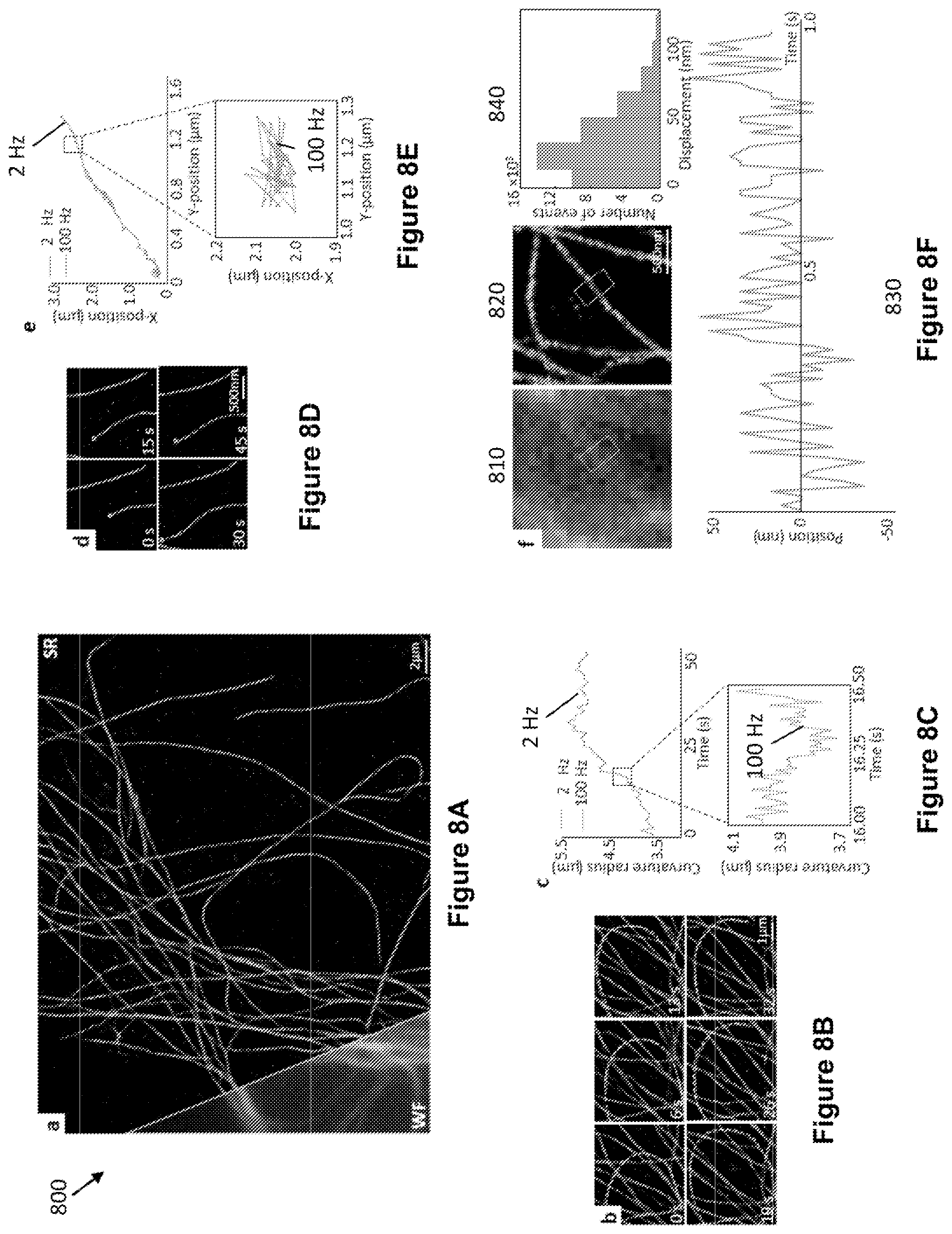 Patent US12327327 Figure 6 – Deep learning based single frame super resolution microscopy image processing