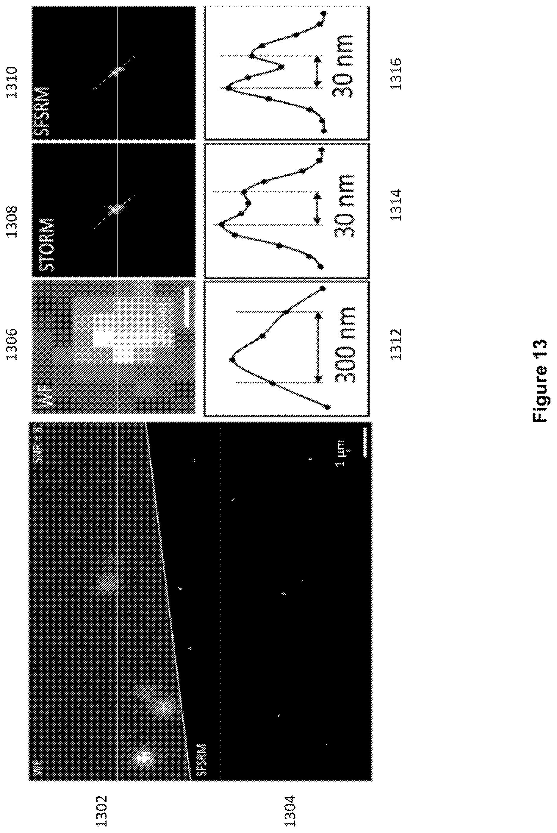 Patent US12327327 Figure 13 – Deep learning based single frame super resolution microscopy image processing